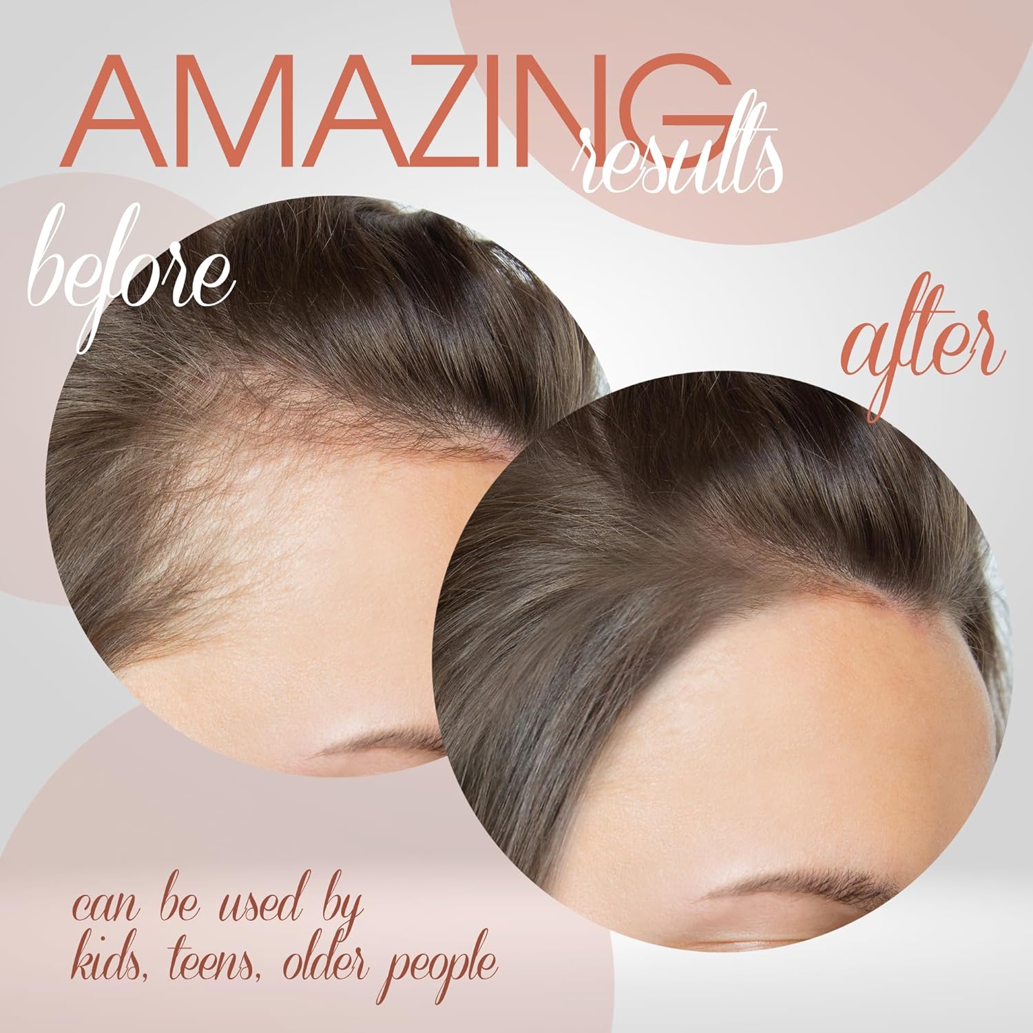 100 ml Raw Batana Oil for Hair Growth - Nourishing & Repairing Hair Styling Agent, Minimizes Hair Loss, Moisturizes Dry Hair, Natural Solution for Gray Hair