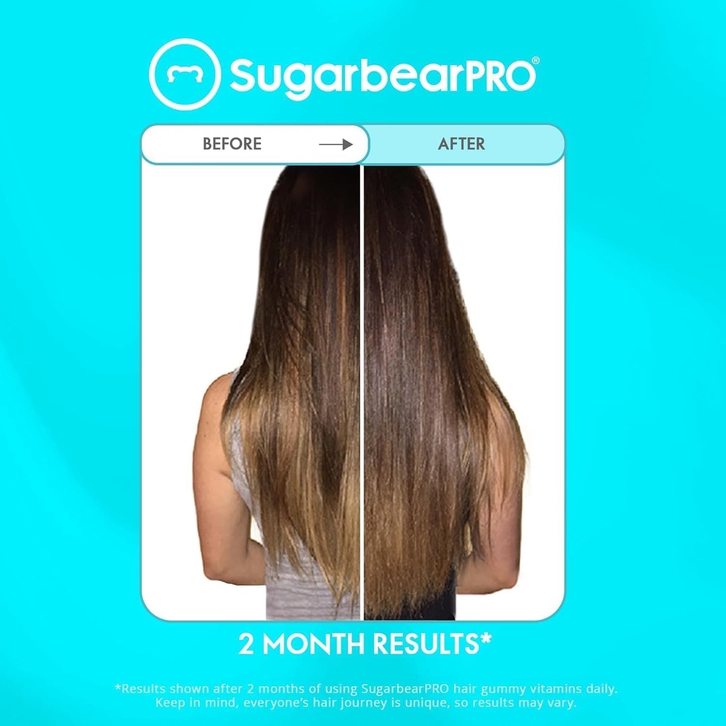 2 Month Supply of SugarbearPro Hair Vitamin Gummies with Pure Batana Natural Hair Growth Oil - Biotin 6000mcg, Vegan, Men, Women, Elderberry, Halal, Cruelty-Free