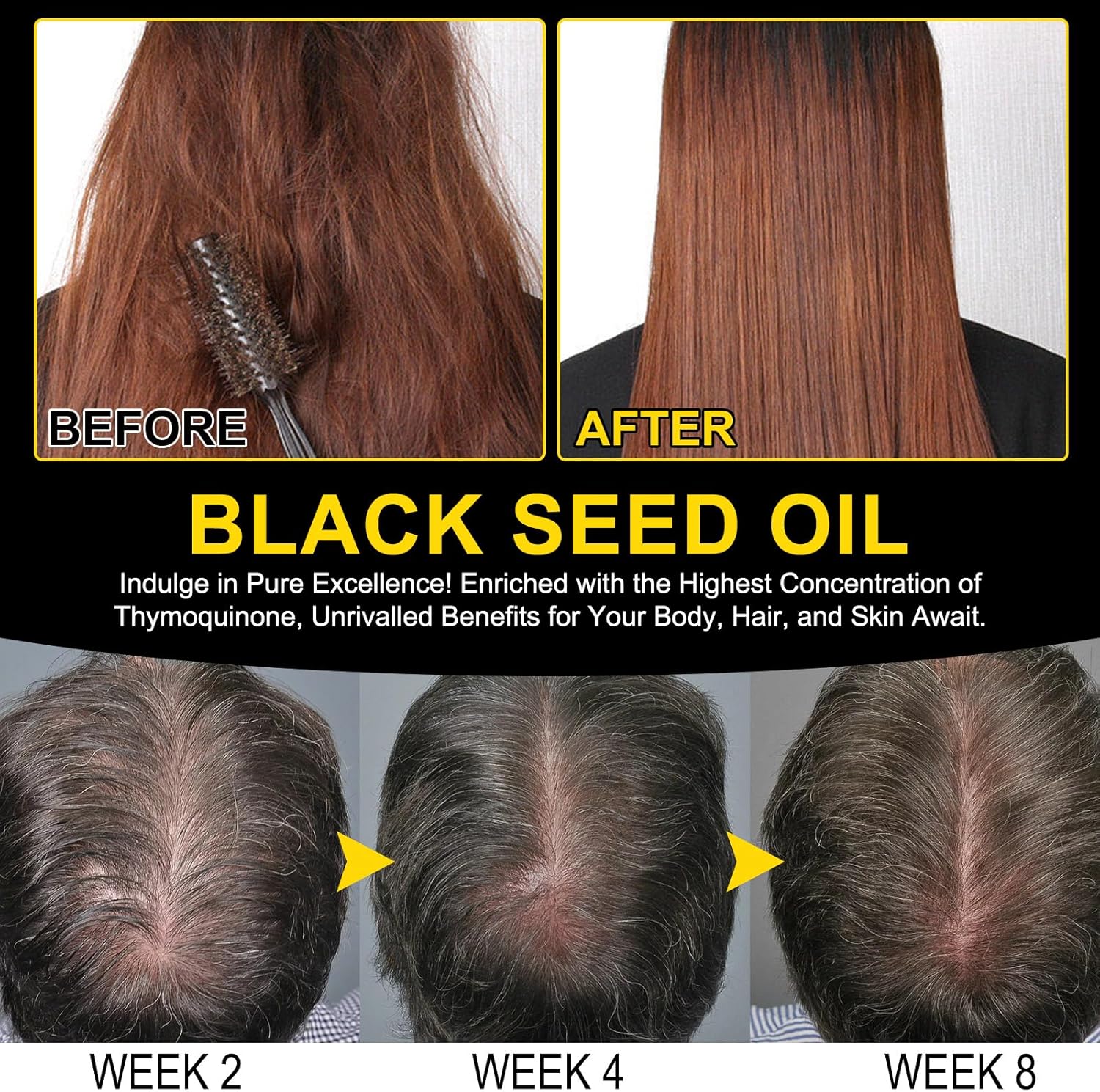 2 Pack Organic Cold Pressed Black Seed Oil for Skin and Hair Care - 100% Pure and Natural Liquid in Glass Bottles (60ML)
