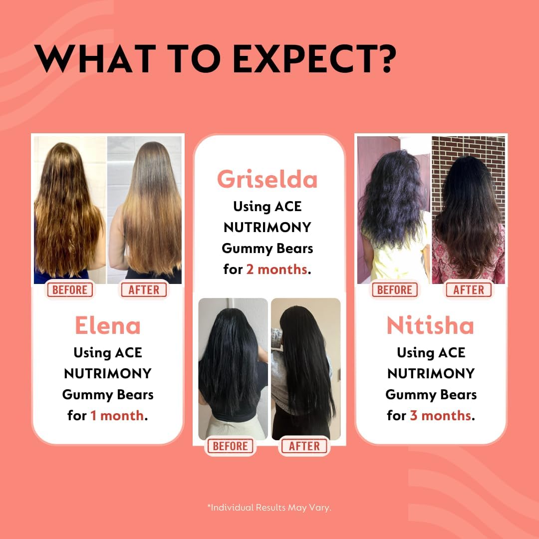 60 Ace Nutrimony Balanced Biotin Gummies for Hair Growth - Vegan Hair Skin and Nails Vitamins for Men & Women, Gluten Free