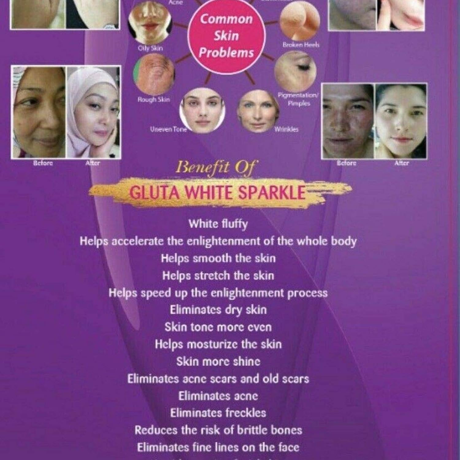 750G Supream Gluta White Sparkle L-Glutathione Skin Whitening Supplement