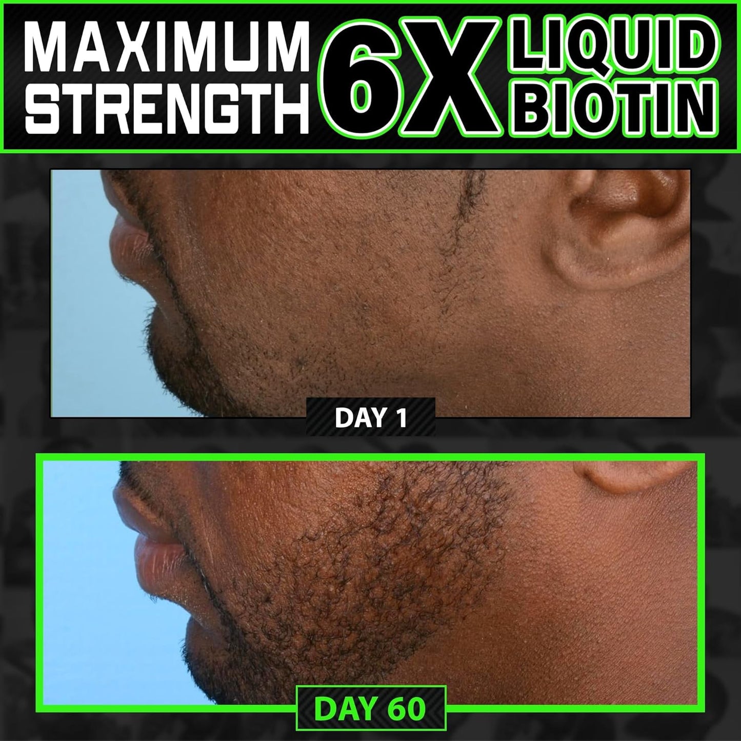 BBS USA Maximum Strength Biotin & Collagen Liquid for Men - Hair & Beard Growth Supplement with 6X Absorption - 2 OZ