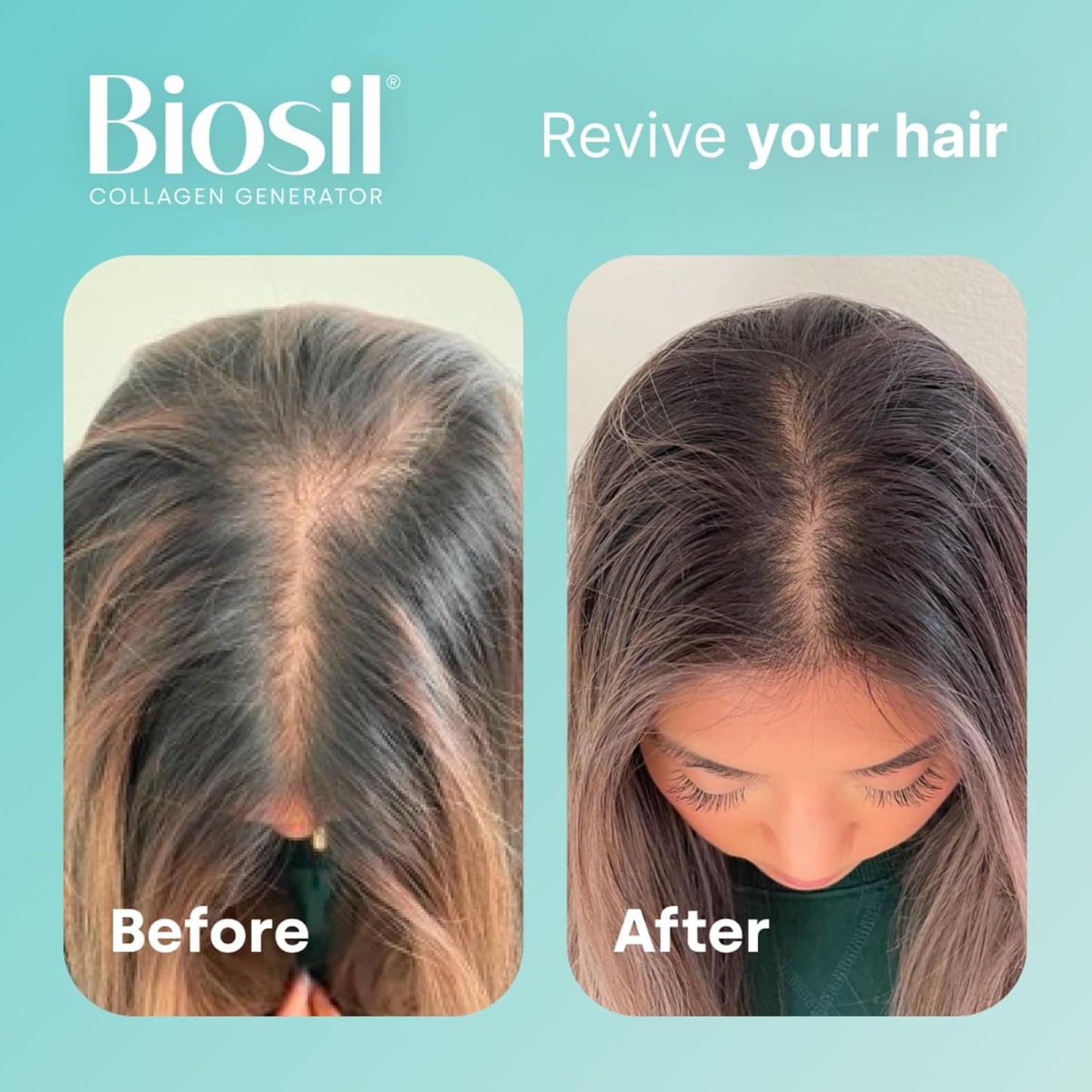 Biosil Collagen Generator Drops - 0.5 fl oz - Patented ch-OSA Complex - Stimulates & Defends Natural Collagen - Non-GMO - 30-Day Supply
