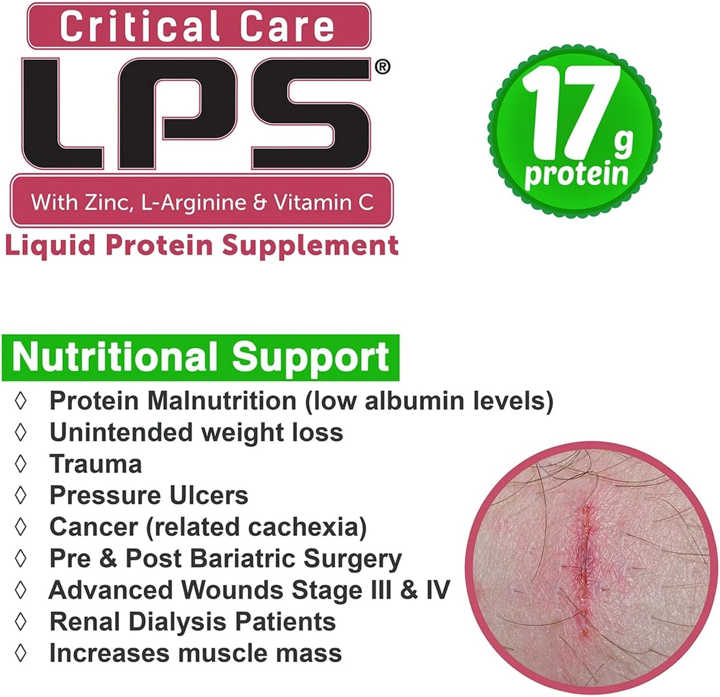 Cherry Flavored LPS Liquid Collagen & Whey Protein Supplement - Non-GMO, Sugar-Free Drink for Healthy Skin & Hair (Critical Care)