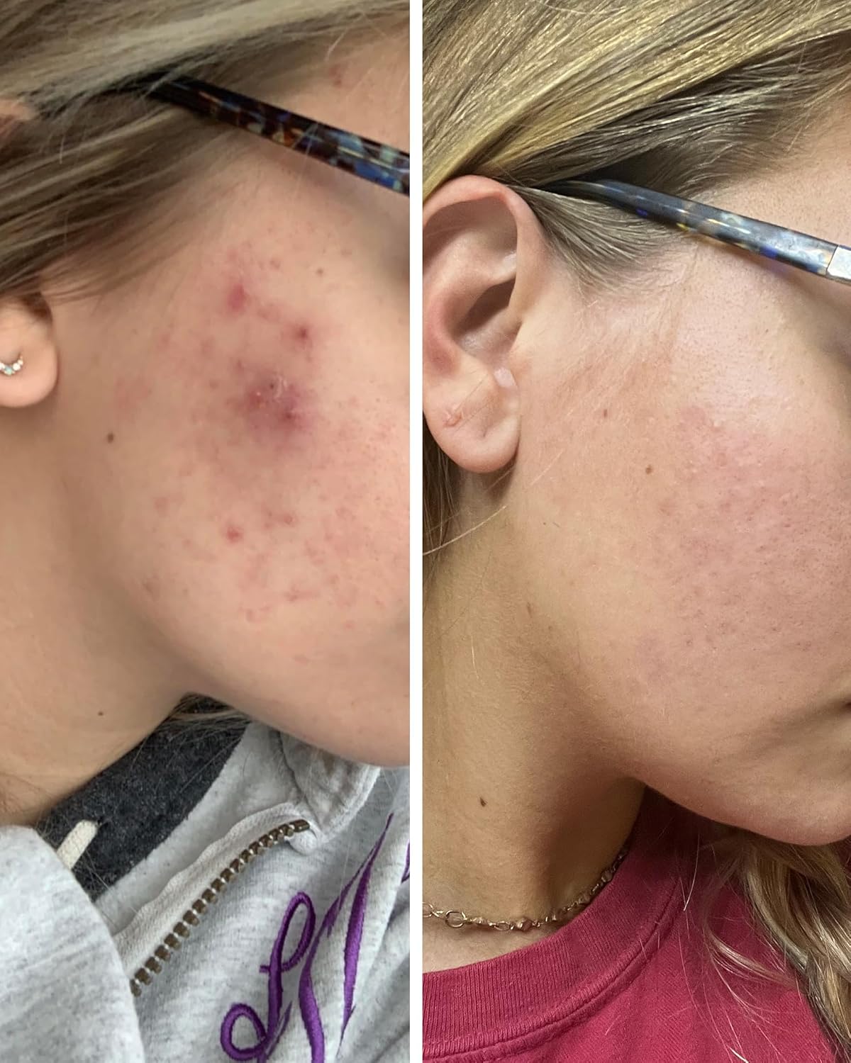 Collagen Peptides Supplement with Verisol, Astaxanthin, and Cat’s Claw for Skin Care & Health, Supports Collagen Regeneration & Antioxidant Protection - 30 Servings