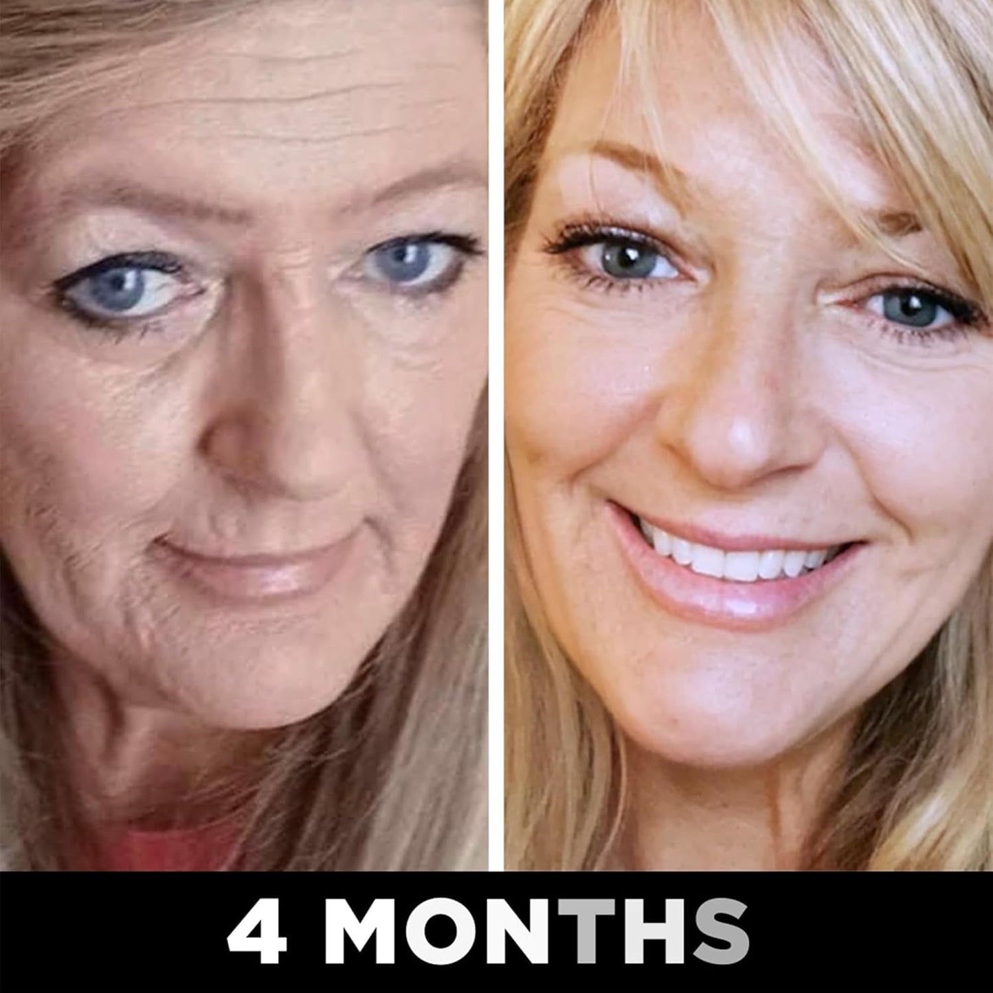 Collagen Peptides Supplement with Verisol, Astaxanthin, and Cat’s Claw for Skin Care & Health, Supports Collagen Regeneration & Antioxidant Protection - 30 Servings