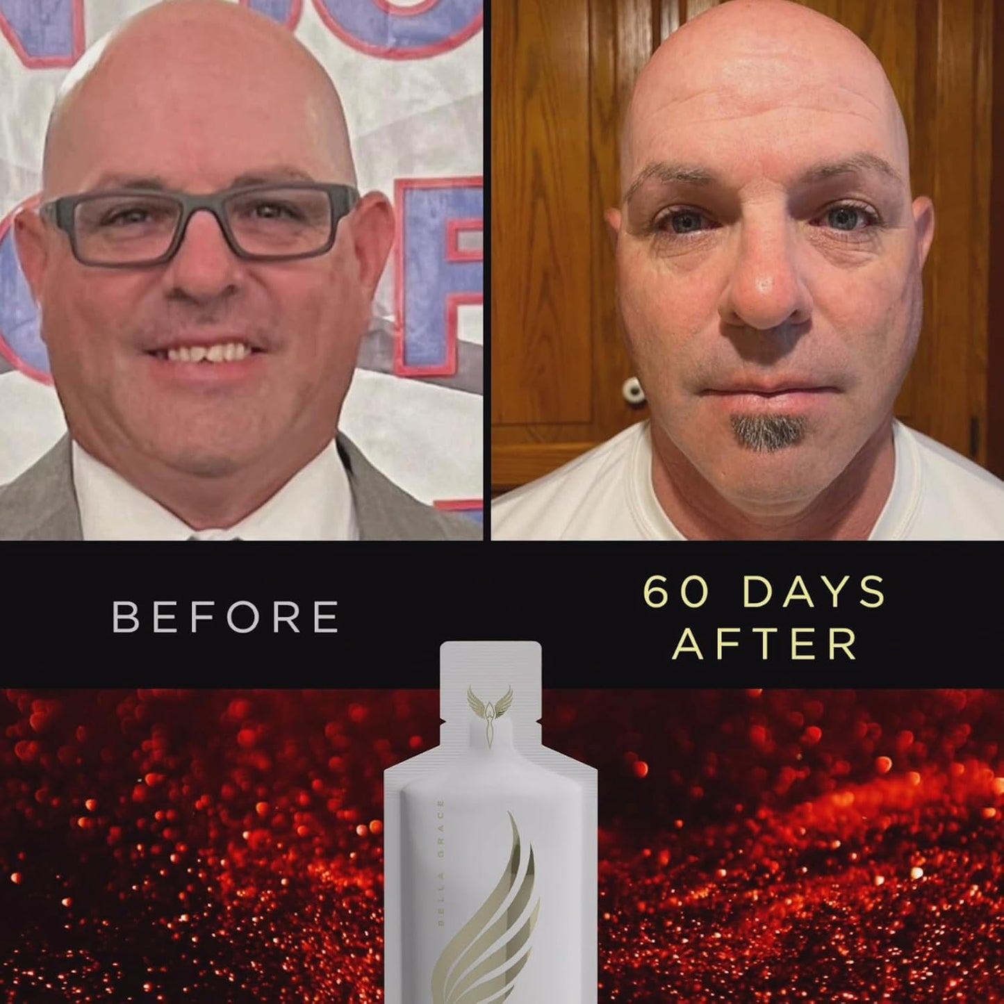 Collagen Peptides Supplement with Verisol, Astaxanthin, and Cat’s Claw for Skin Care & Health, Supports Collagen Regeneration & Antioxidant Protection - 30 Servings