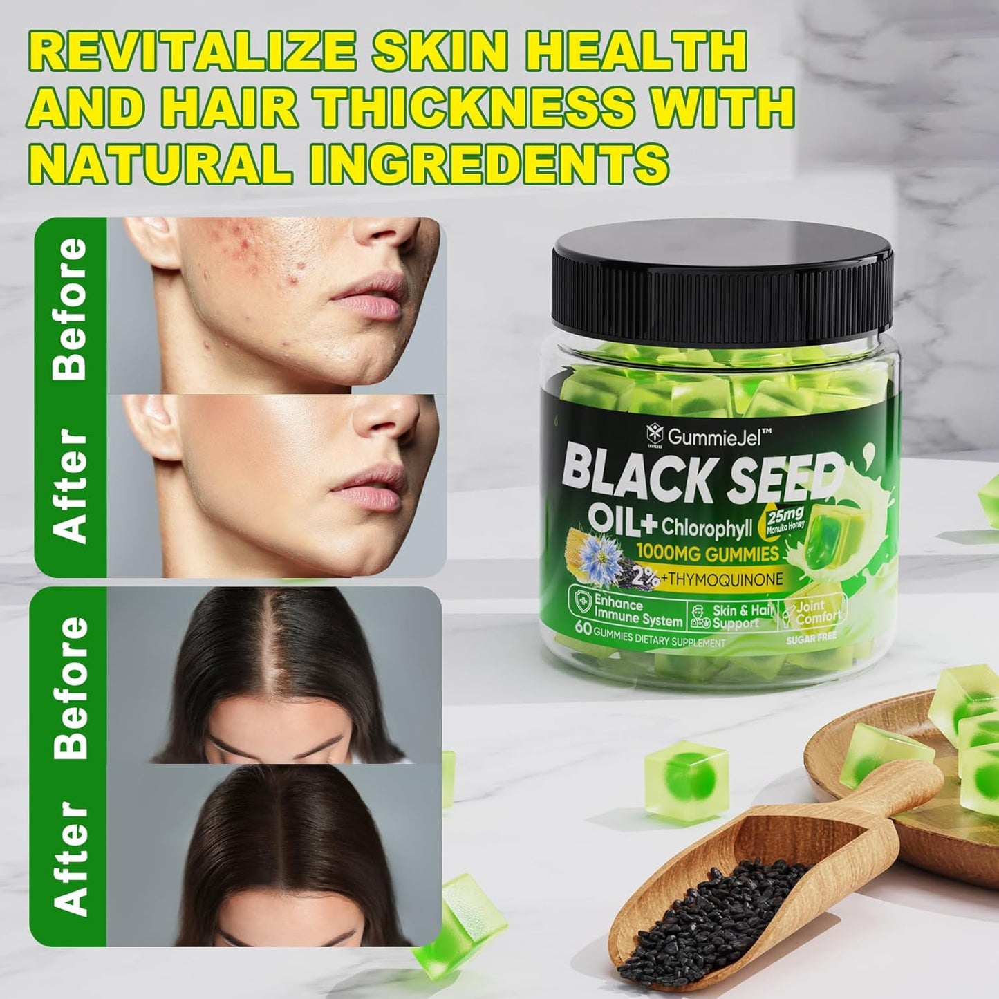 EnvyCure Black Seed Oil Gummies with Chlorophyll, Biotin, Collagen, Manuka Honey - Skin, Hair, Nails Health, Digestive Support - Sugar Free