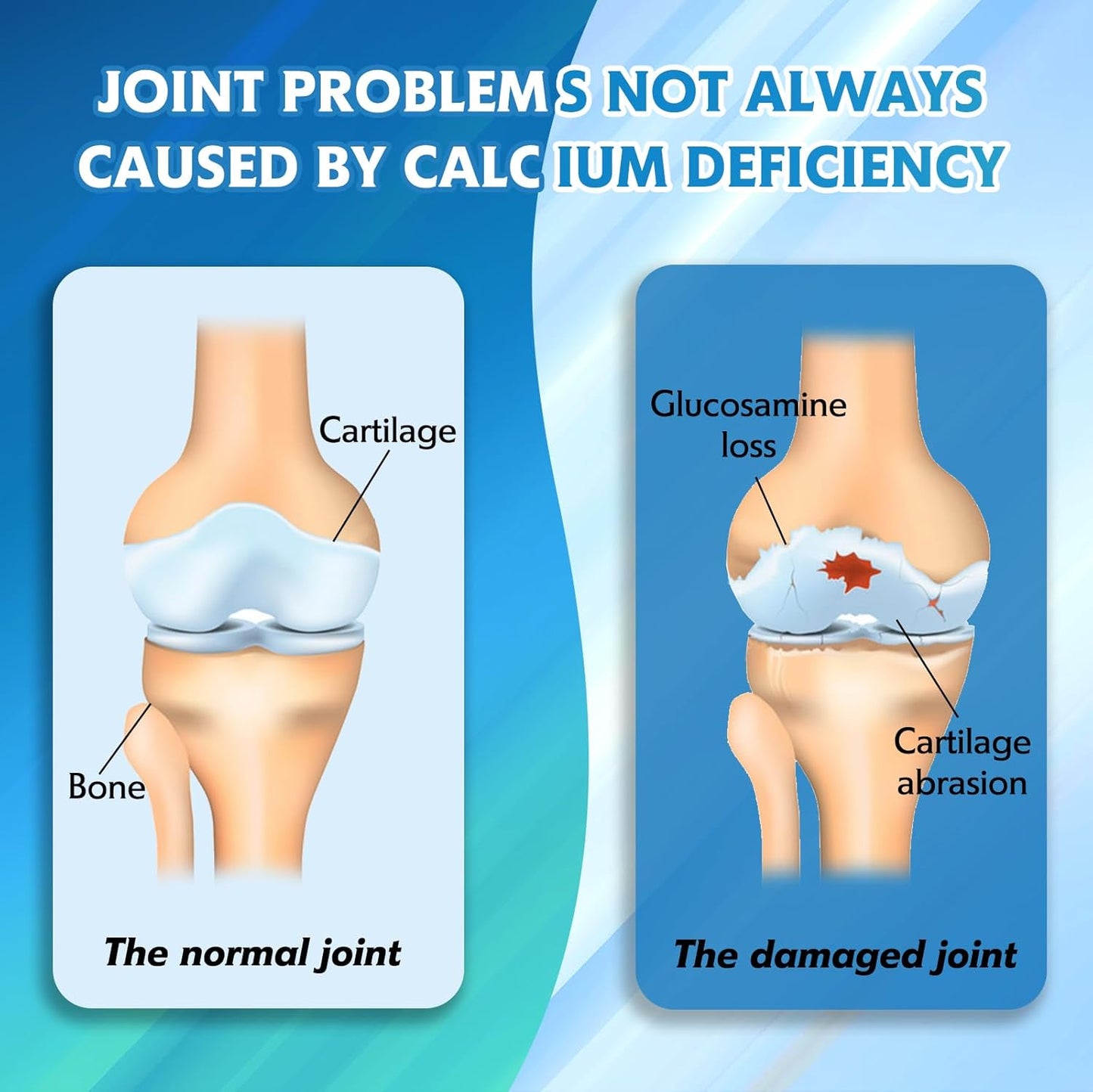 Extra Strength Glucosamine Chondroitin MSM Complex for Healthy Joints & Cartilage - 120 Tablets