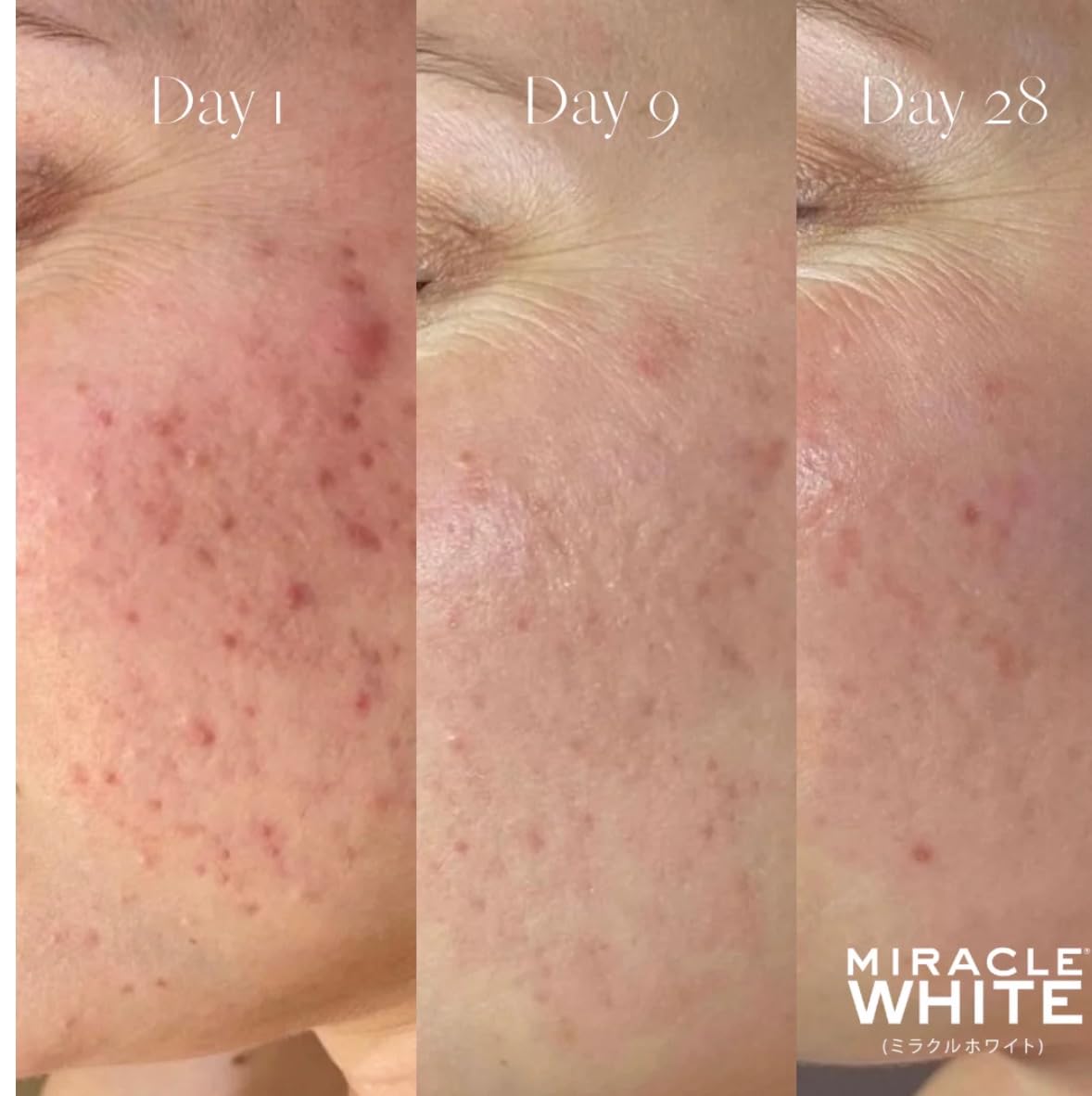 Glutathione Beauty Glow Supplement for Radiant Skin & Overall Wellness