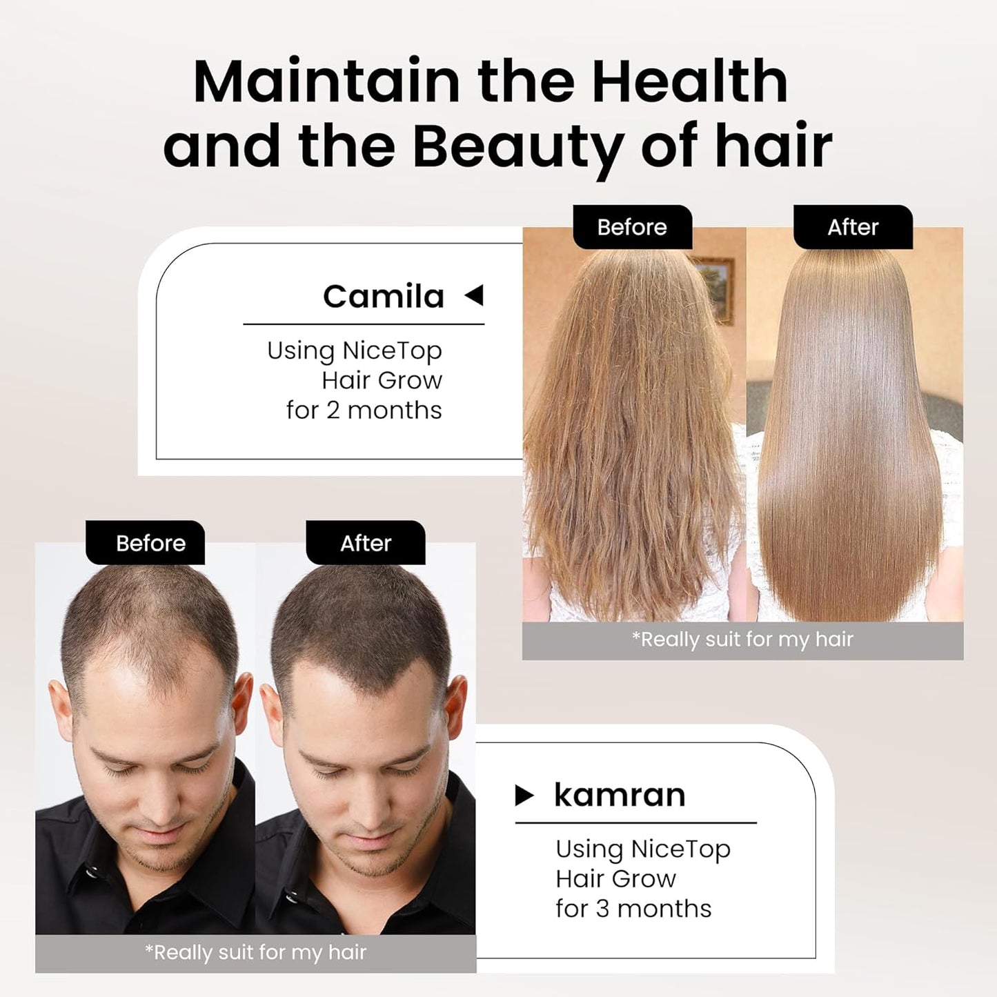 Hair Growth Supplement with Biotin, Vitamins A, C, E, Zinc - Supports Strength, Thickness, Growth - 60 Capsules
