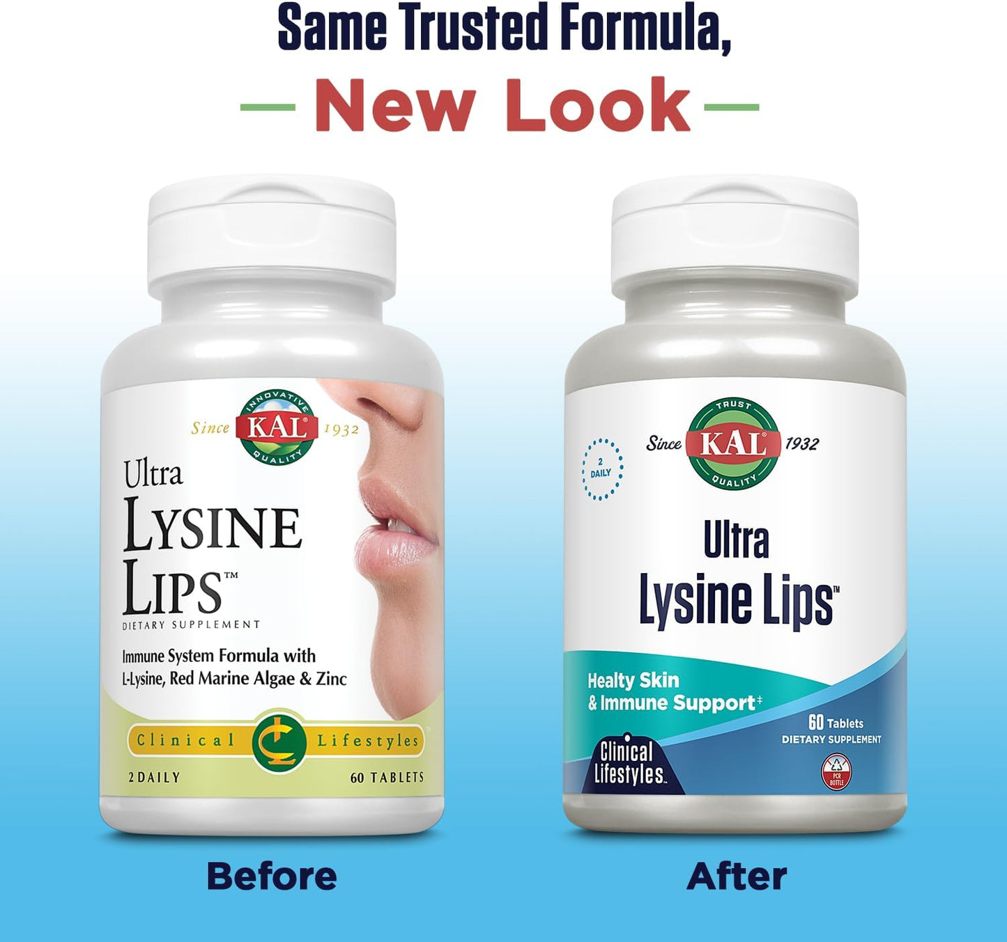 Kal Ultra Lysine Lips Tablets - 60 Count - Supports Lip Health and Immune System