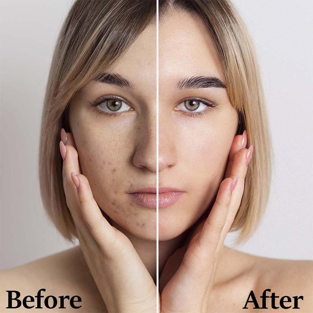 mi Nature Aloe Vera Gel Powder 200x | Pure Aloe Barbadensis | 100g (3.5oz) | Highly Concentrated for Digestive Support & Cosmetics