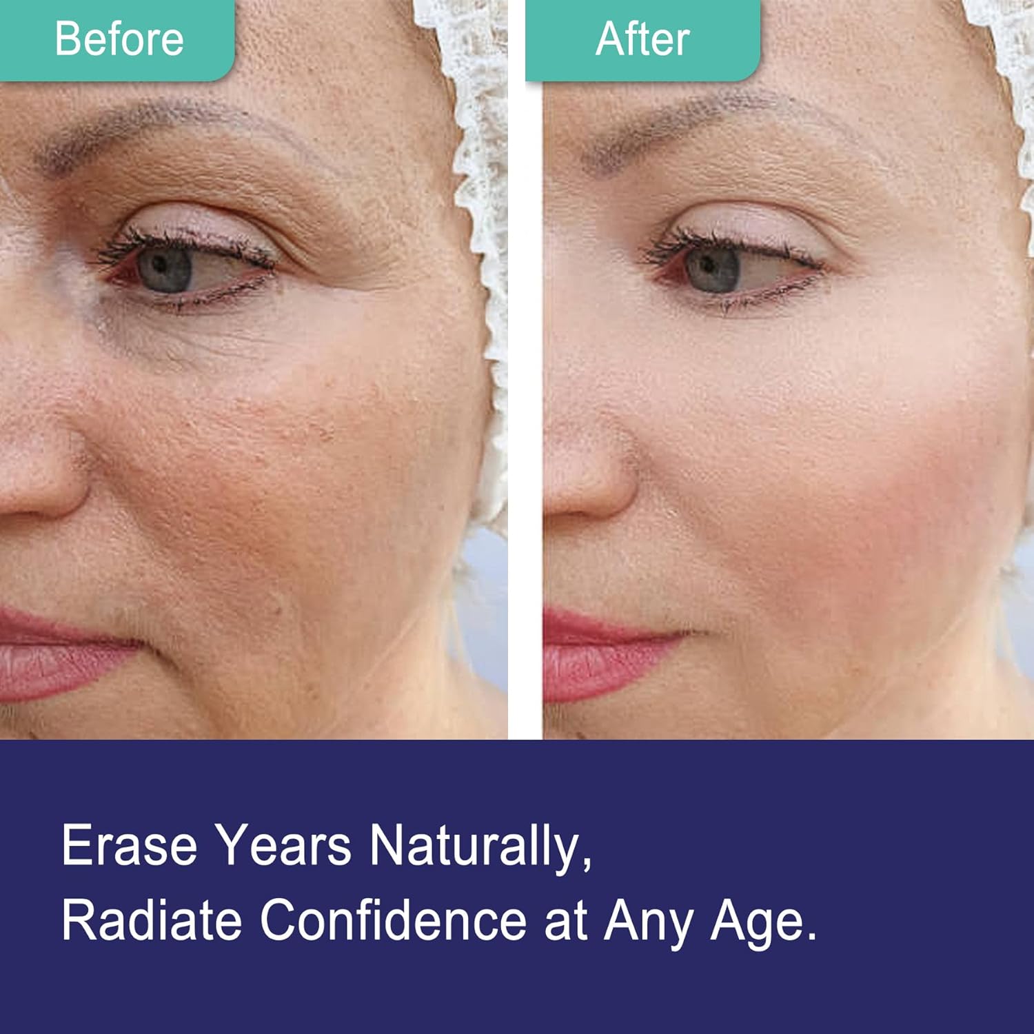 NEVISS Nicotinamide 500mg Gummies: NAD+ Supplement with Collagen Peptides for Healthy Aging, Longevity, and Brain Health - 120 Count