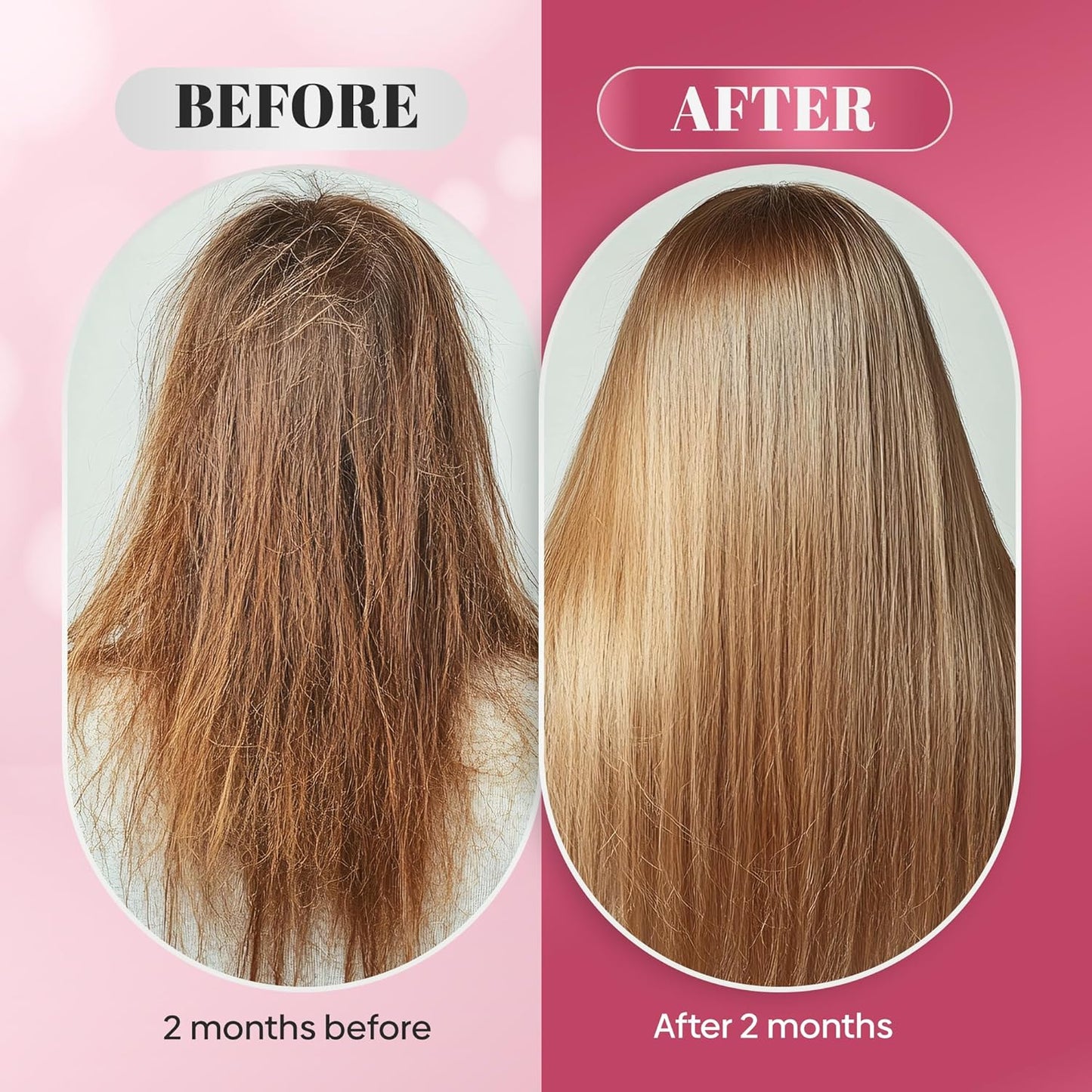 Nutrafemi Biotin Gummies for Women - 60 Gummies with 5000 mcg Biotin for Strong Hair, Healthy Nails, Glowing Skin