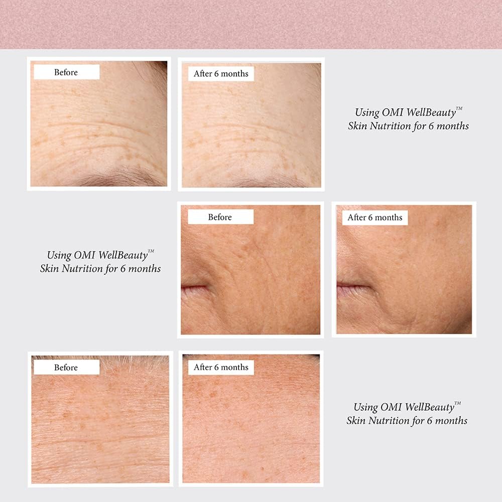 OMI Wellbeauty Skin Nutrition: Clinically Proven Anti-Aging Formula with French Marine Elastin, Collagen, Hyaluronic Acid, Vitamin C - 1 Month Supply