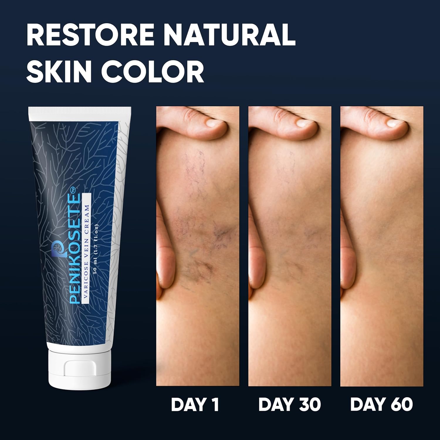 Penikose Varicose Vein Care Bundle - Herbal Tablets & Ashwagandha Leg Cream with Punarnava & Turmeric