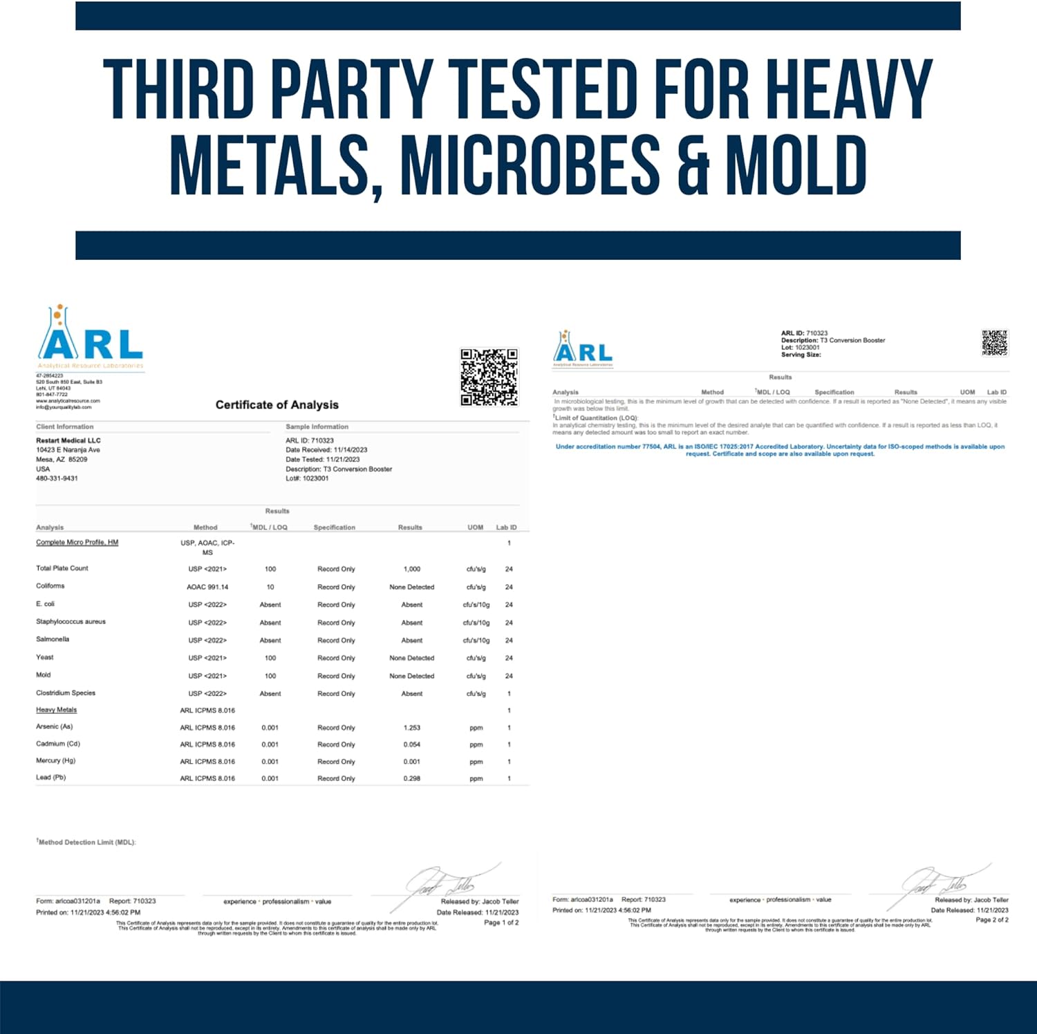 Thyroid Support Supplement for Women with Hypothyroidism & Hashimoto’s - T3 Conversion Enhancer - Iodine, Ashwagandha, Guggul Extract, Selenium & Zinc - 60 Servings