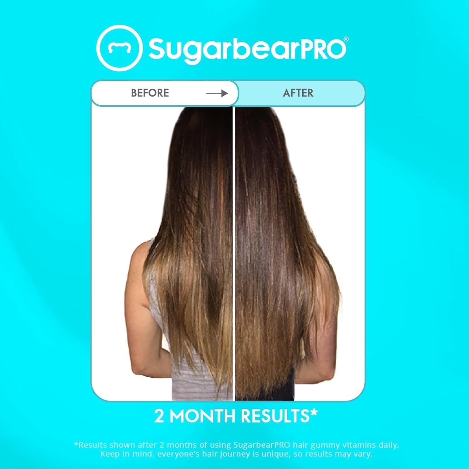 2 Month Supply of SugarbearPro Hair Vitamin Gummies with Pure Batana Natural Hair Growth Oil - Biotin 6000mcg, Vegan, Men, Women, Elderberry, Halal, Cruelty-Free