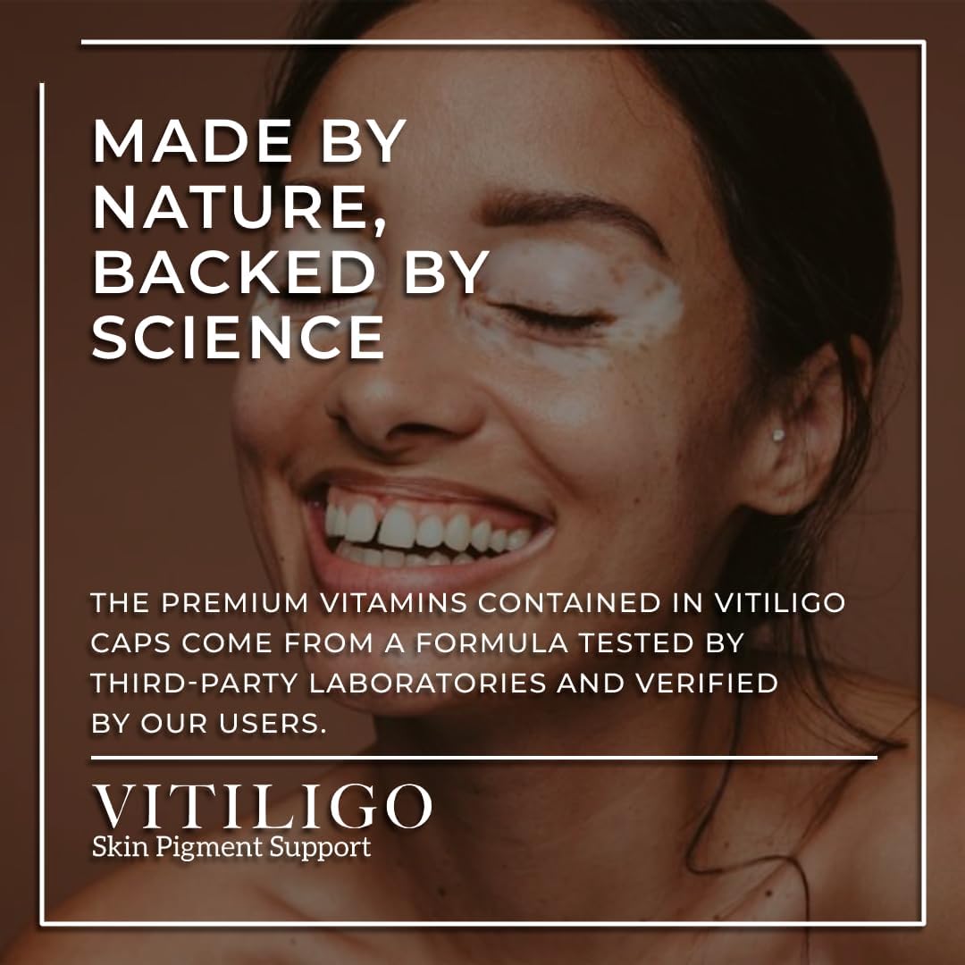 60 Count Dermawonder Vitiligo Capsules - Effective Supplement to Reduce White Spots, Improve Skin Pigmentation & Support All Skin Types