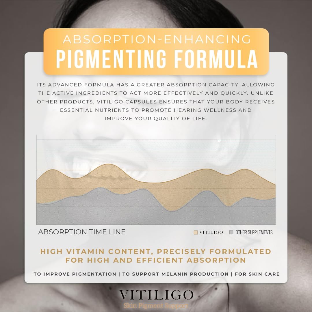 60 Count Dermawonder Vitiligo Capsules - Effective Supplement to Reduce White Spots, Improve Skin Pigmentation & Support All Skin Types