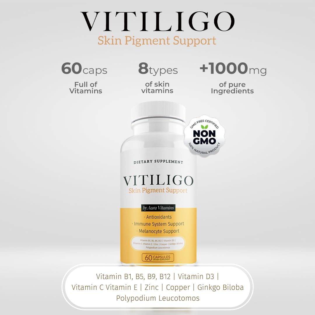 60 Count Dermawonder Vitiligo Capsules - Effective Supplement to Reduce White Spots, Improve Skin Pigmentation & Support All Skin Types