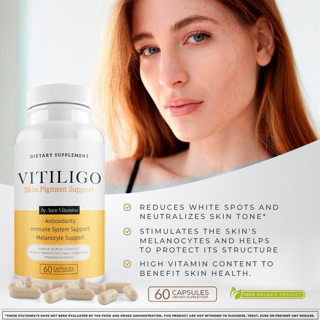 60 Count Dermawonder Vitiligo Capsules - Effective Supplement to Reduce White Spots, Improve Skin Pigmentation & Support All Skin Types