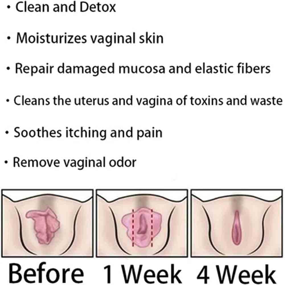 8-Bag Instant Anti-Itch Detox Capsules for Firming Repair, Pink and Tender Skin - Stay Clear and Fresh with Natural Ingredients