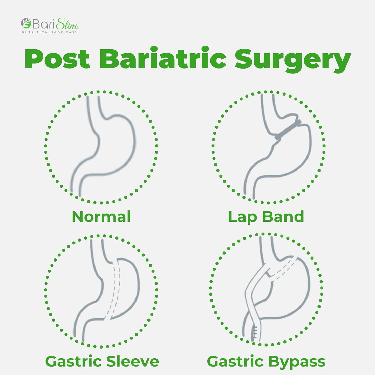 90 Count BariSlim Complete Chewable Bariatric Multivitamin with Iron for Post Surgery - Strawberry Flavor - Ideal for Gastric Bypass and Sleeve - BoostGo Australia