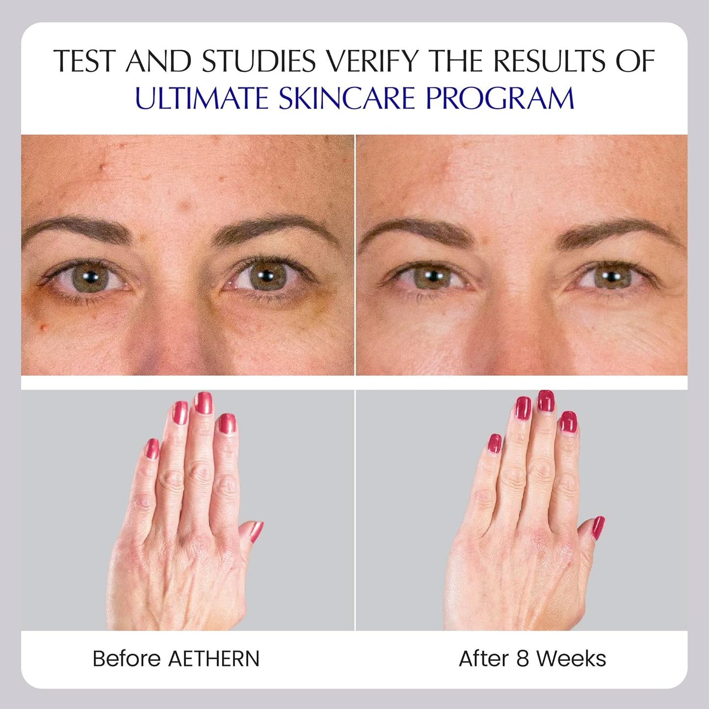 AETHERN Liquid Collagen and Hyaluronic Acid Supplement for Hydrated, Glowing Skin. Clinically Proven. UV Protection. 28 Servings