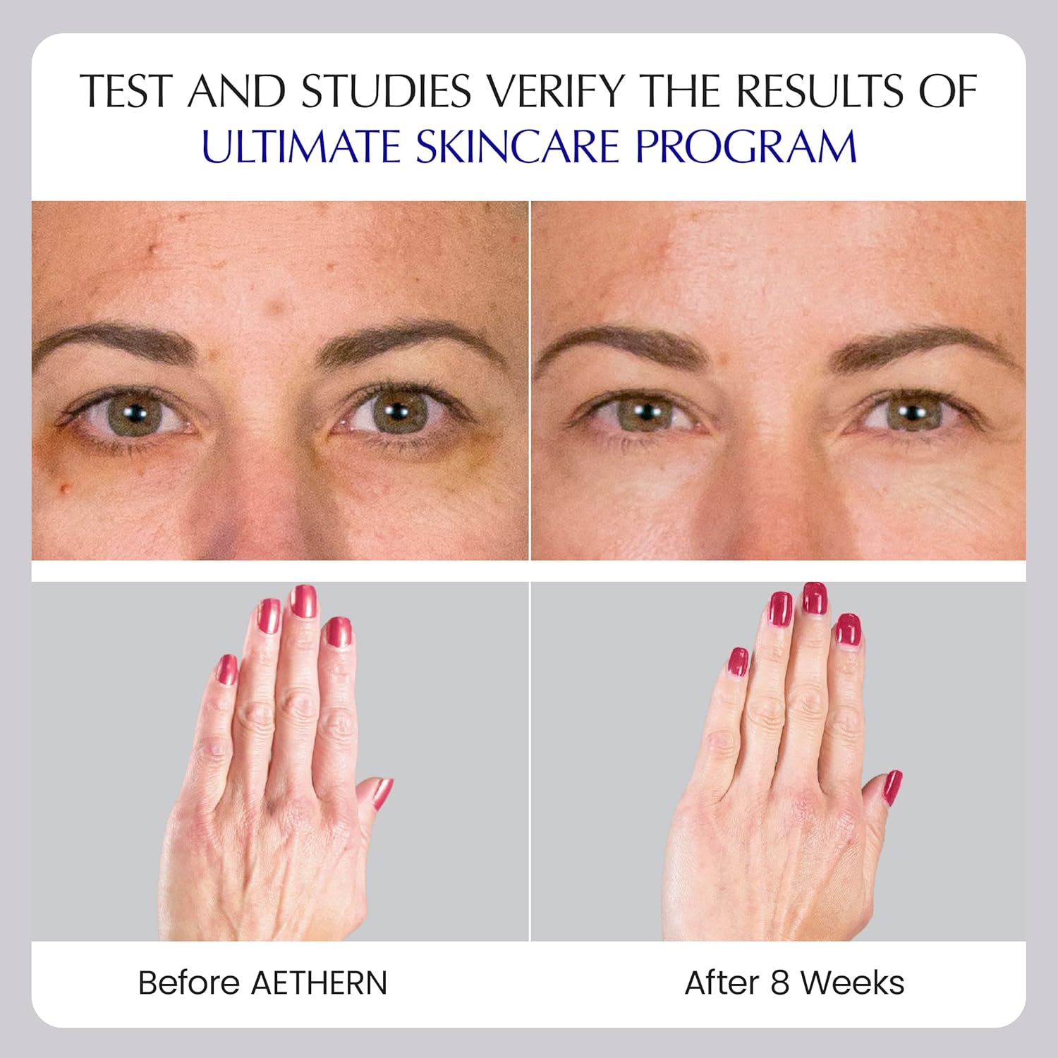 AETHERN Liquid Collagen and Hyaluronic Acid Supplement for Hydrated, Glowing Skin. Clinically Proven. UV Protection. 28 Servings