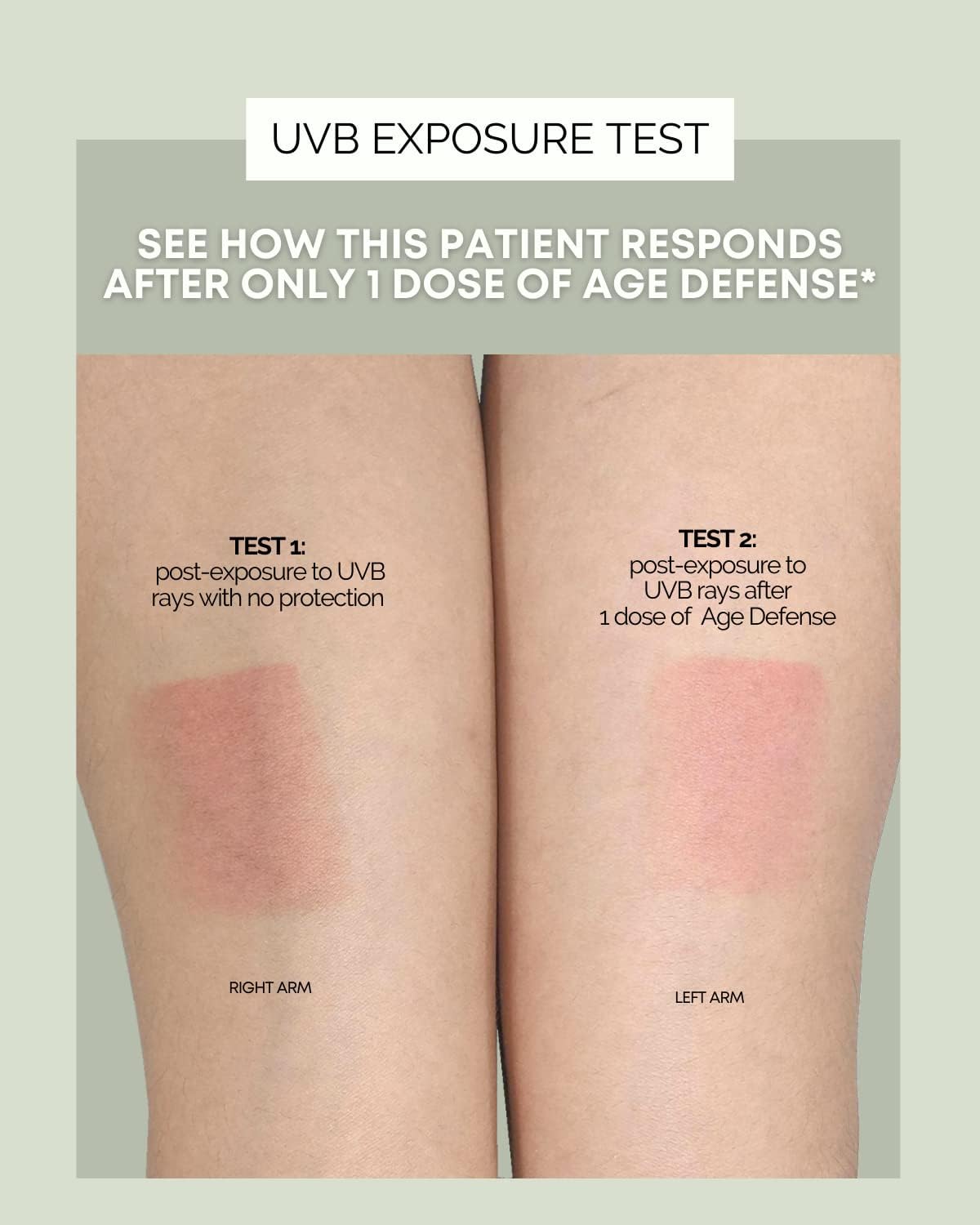 Age Defense Vitamins for Inner Glow - Developed by Dermatologists and Plastic Surgeons to Combat Melasma and Photoaging with Polypodium Leucotomos and Pycnogenol