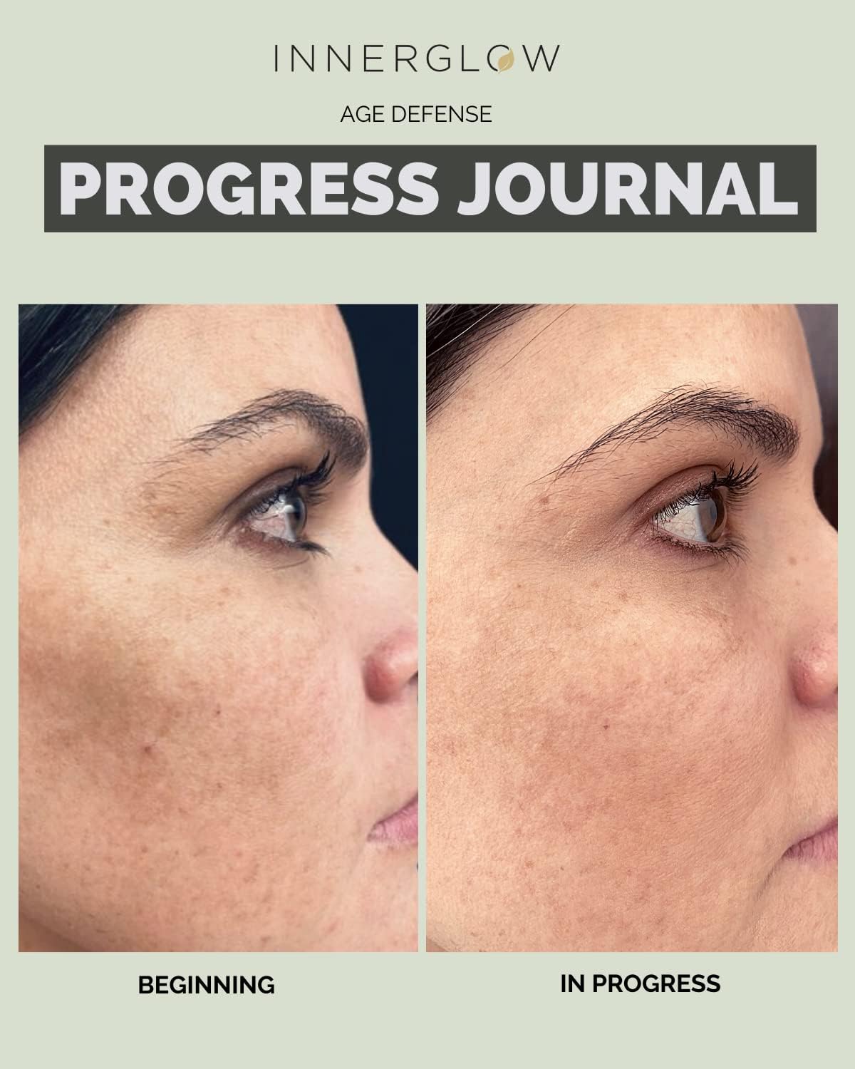 Age Defense Vitamins for Inner Glow - Developed by Dermatologists and Plastic Surgeons to Combat Melasma and Photoaging with Polypodium Leucotomos and Pycnogenol