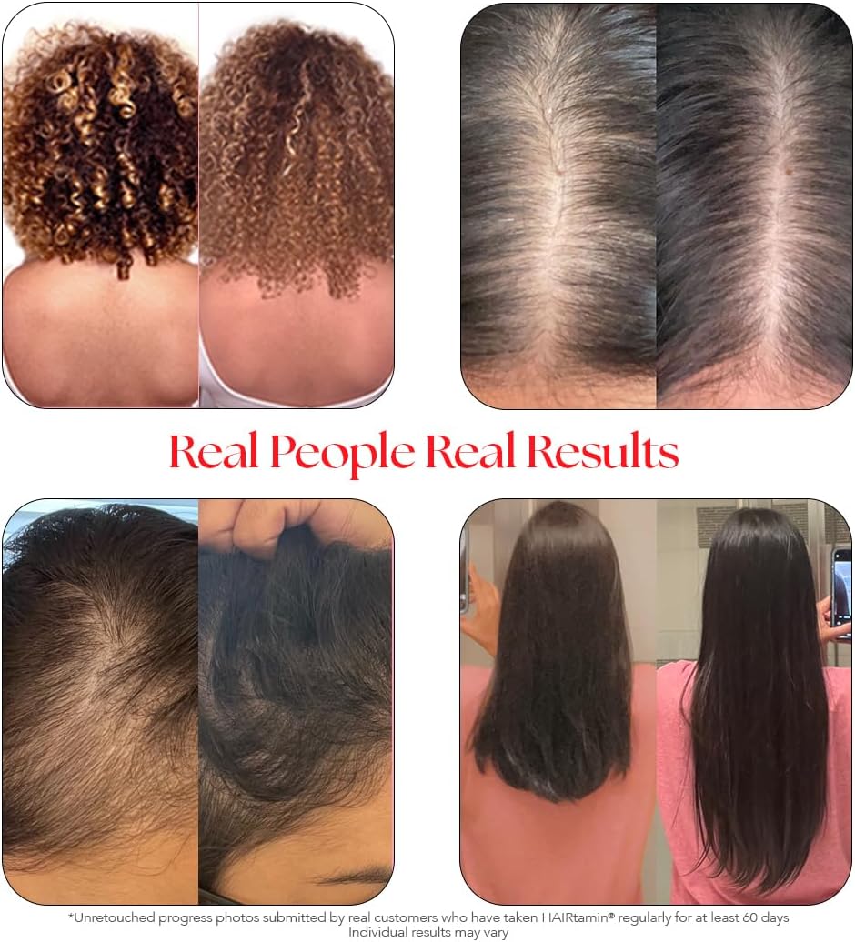 All-Natural Vegan Biotin Hair Growth Serum and Capsules Set for Hair, Skin, and Nails