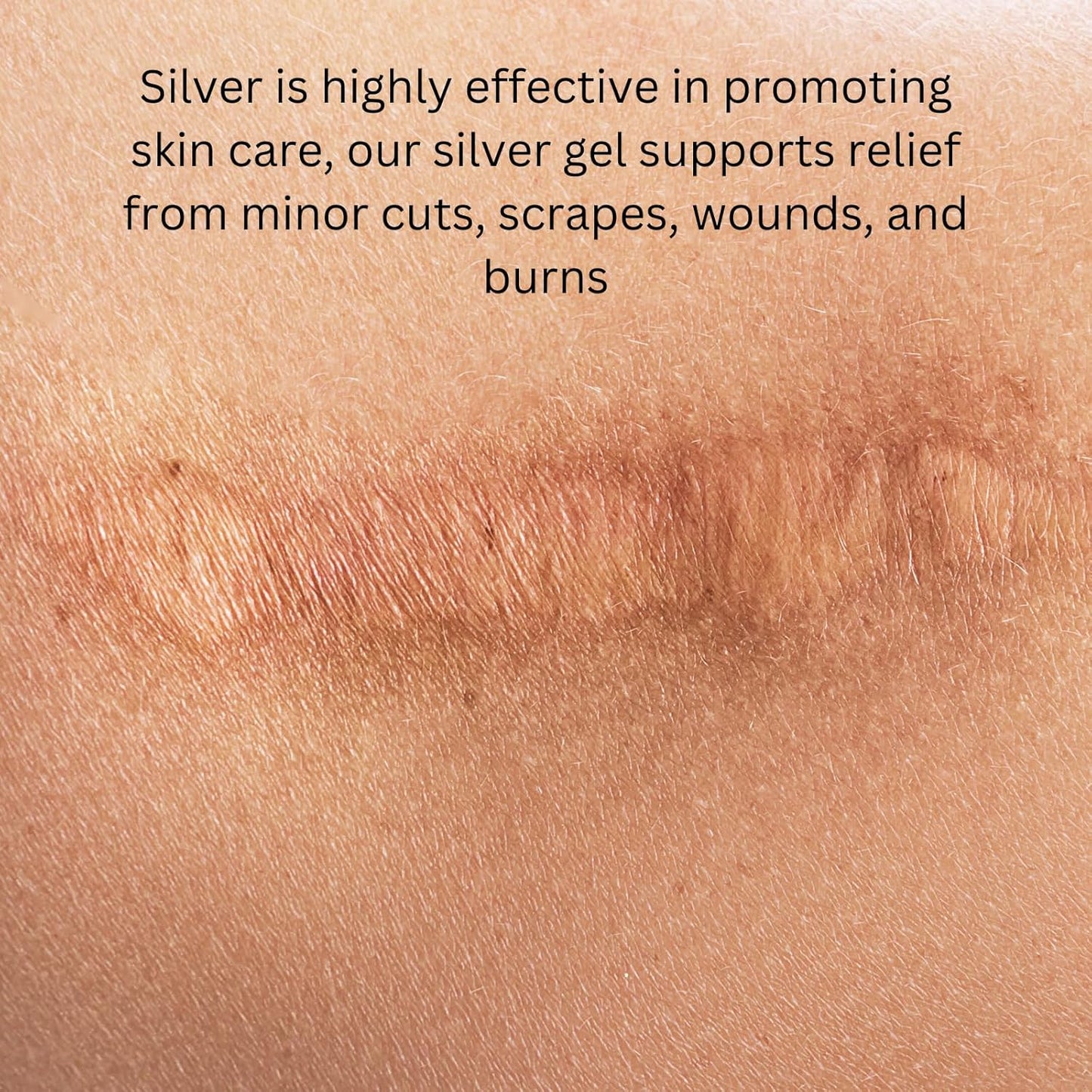 Ameo Life Colloidal Silver Gel 35 ppm - pH Balanced for Healthy Skin, Minor Cuts, Scrapes & Burns - Natural Skin Care Rejuvenation - 100ml
