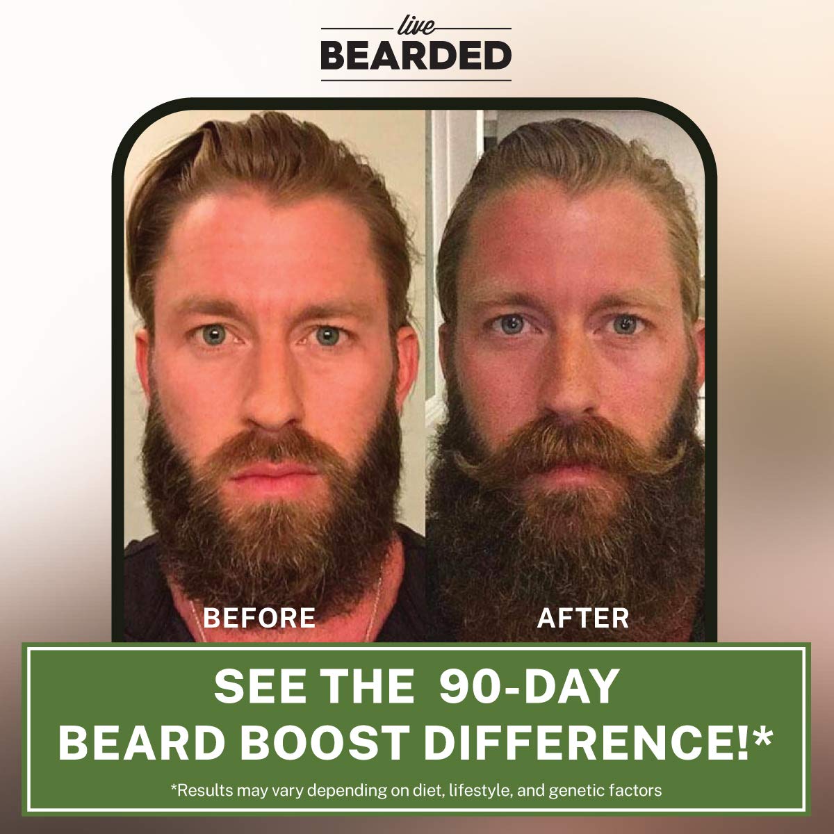 Beard Boost Hair Growth Multivitamins with Biotin 10,000mcg, Vitamins C, E, and Zinc | USA Made - 90-Day Supply for Thick, Strong Beards