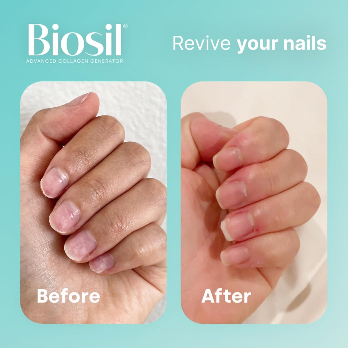 Biosil Collagen Generator Capsules - 180 Liquid Capsules - Patented ch-OSA Complex - Generate & Protect Collagen - Non-GMO - 90-Day Supply