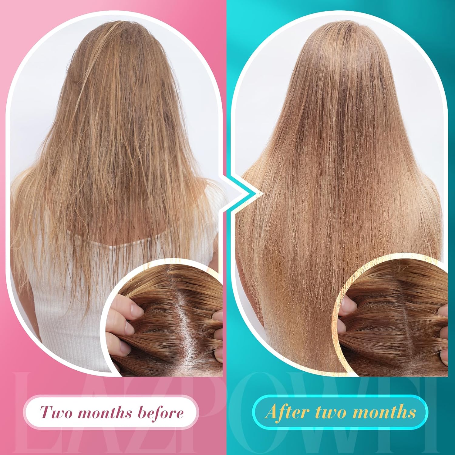 Biotin Gummies for Hair Skin and Nails Growth - Vegan Vitamin B7 Supplement for Men & Women - 120 Day Supply - Raspberry Flavor - BoostGo Australia
