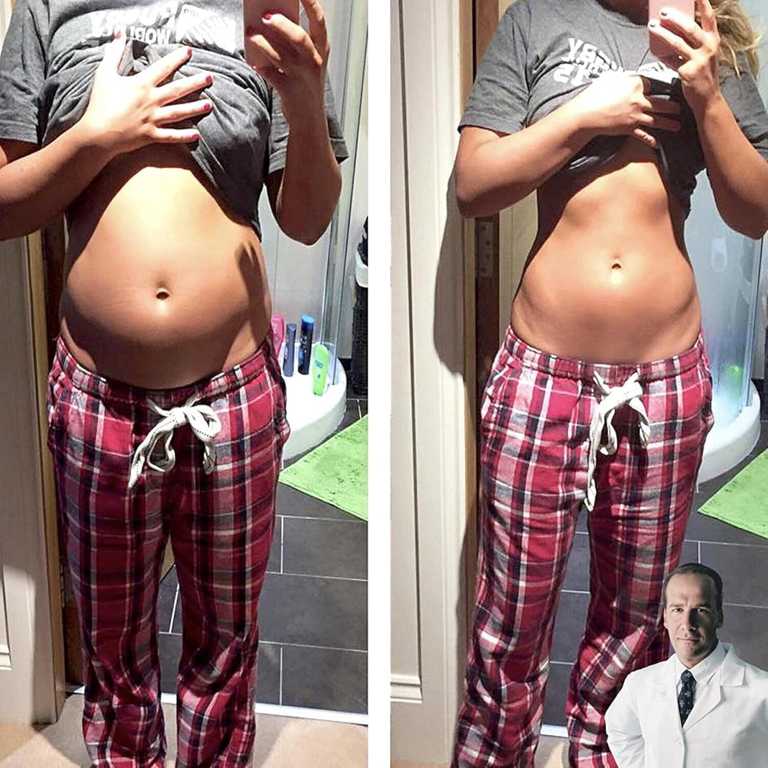 Digestive Enzymes for Abdominal Bloating Reduction - Supports Digestion of Various Foods - Kids and Adults - 60 Capsules