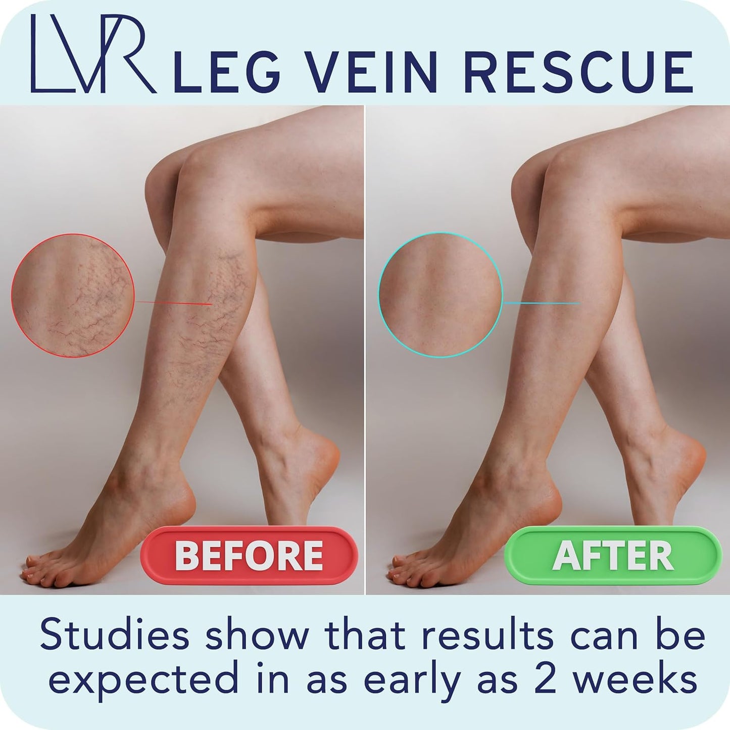 Diosmin Varicose Vein Support Supplement - Clinically Proven Leg Circulation Relief - Spider Veins & Edema Relief - Citrus Bioflavonoids - 90 Capsules