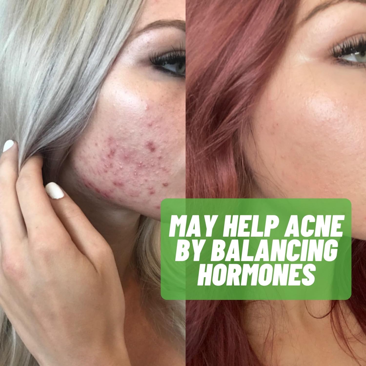 Estrohalt Estrogen-Blocker Supplement - Natural Aromatase Inhibitor for Hormone Balance - DIM & I3C Pills for Men & Women