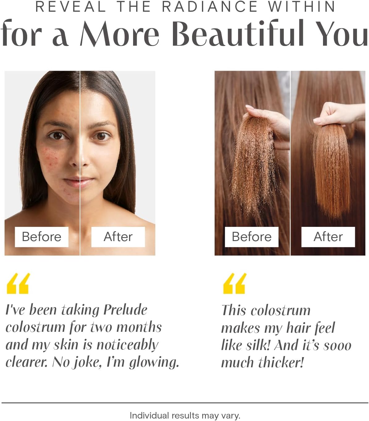 Grassfed Bovine Colostrum Powder Sticks for Gut Health, Immunity, and Wellness - Supports Hair, Skin, and Digestive Health - Made in USA