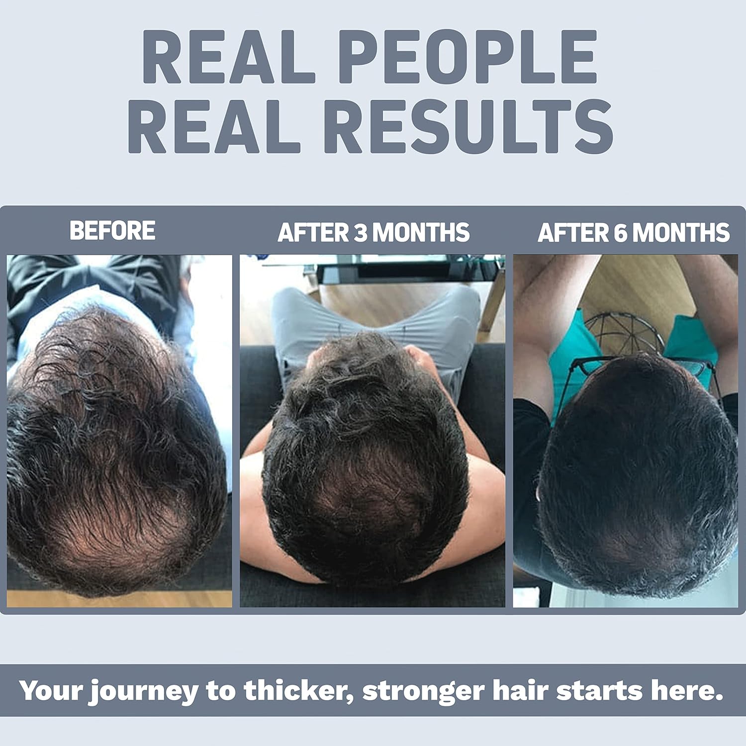 Herbtonics Foli-Tonic Hair Loss Supplement with DHT Blocker for Men's Health - Promotes Thicker Hair Growth and Supports Prostate Health