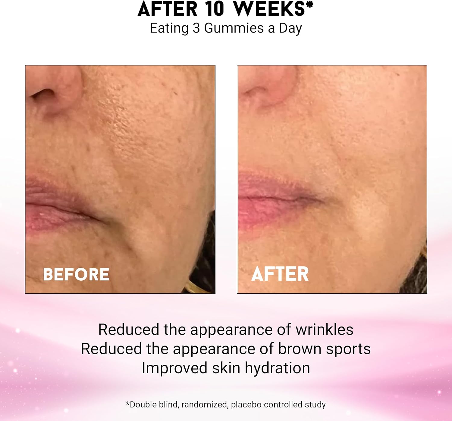 Joyce Giraud Ultimate Beauty Gummies: Miracle Elixir Collection for Skin Hydration & Tone, 30-Day Supply, 90 Gummies