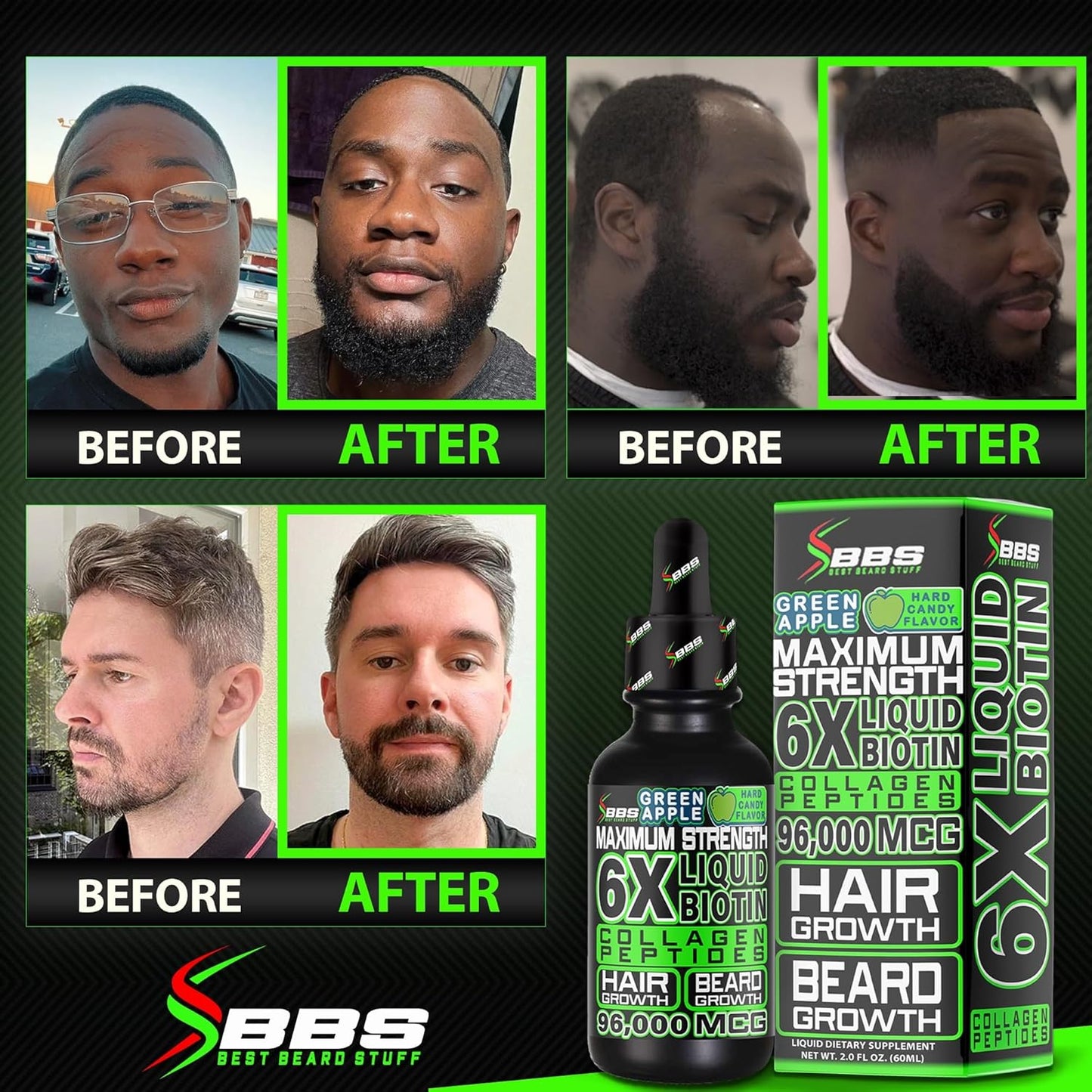 Men's Beard Growth Kit: Liquid Biotin Supplement, Collagen Peptides, 620,000mcg Biotin Gummies - Hair Growth Vitamins