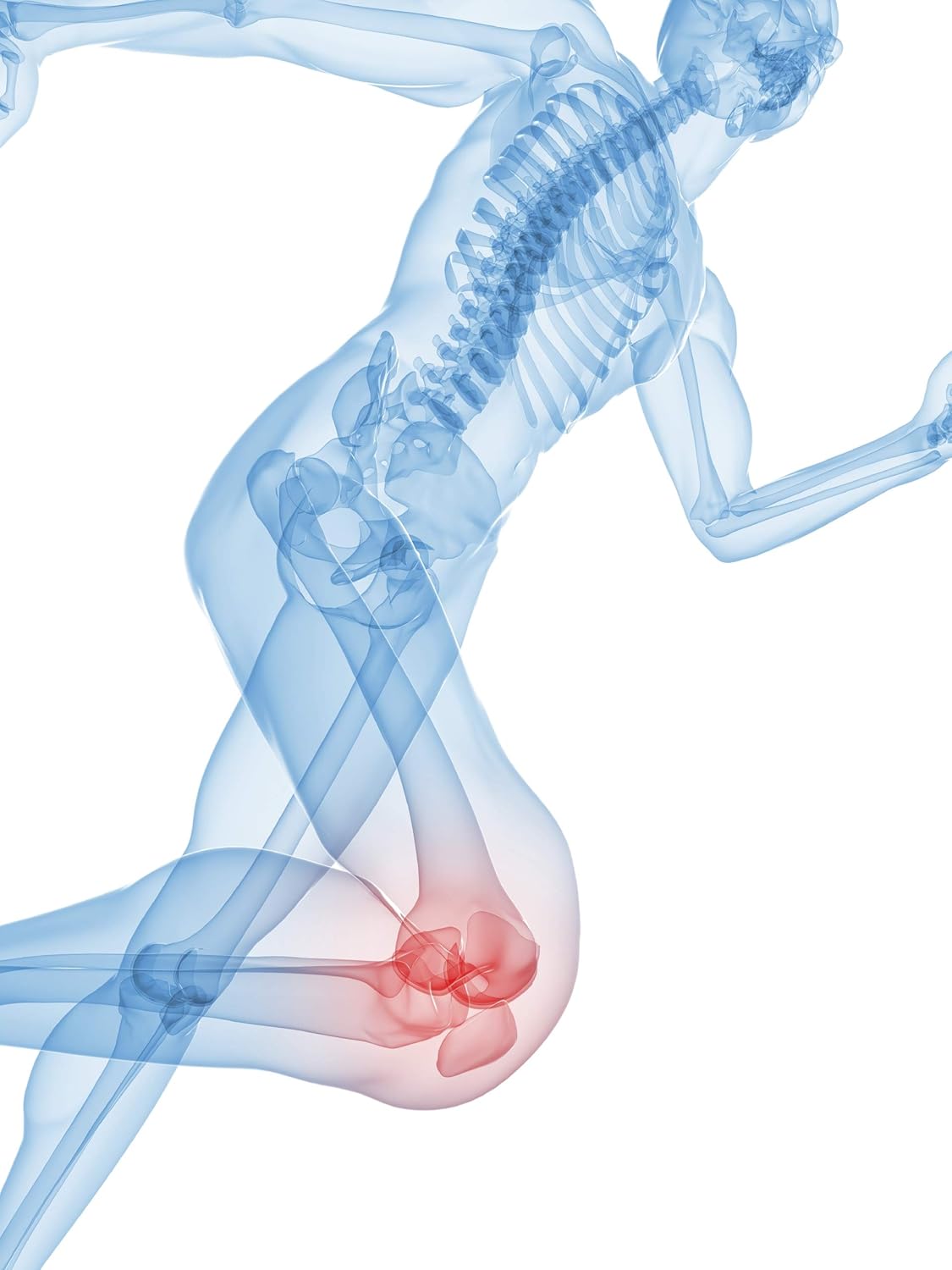 Ostinol 350 Bone & Joint Supplement with Cyplexinol - 30 ct Capsules for Moderate Bone Loss & Joint Disfunction
