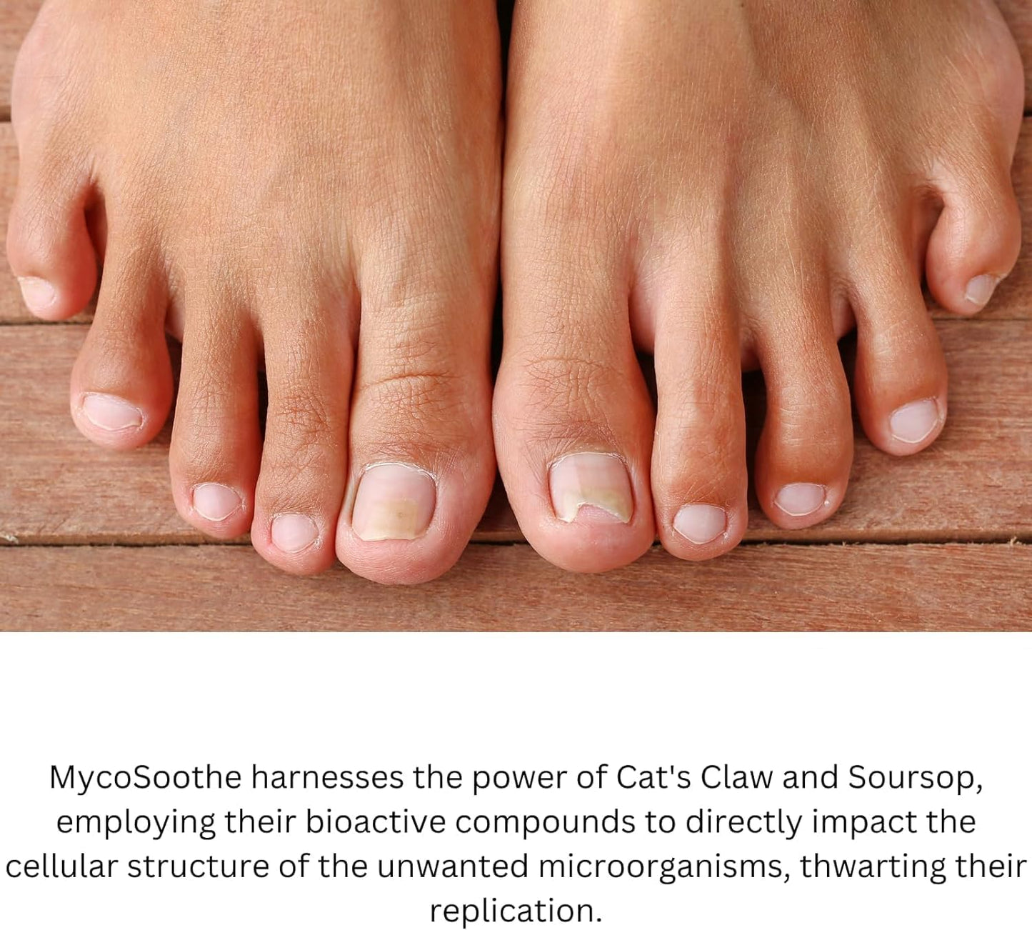 Phytage Labs MycoSoothe Advanced Hair, Skin, Nail & Immunity Support Formula - Double Pack