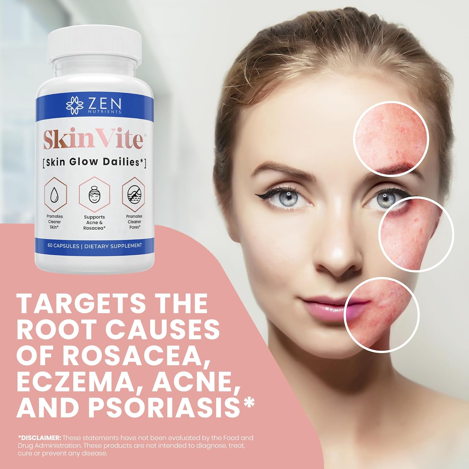 SkinVite Natural Skin Supplement - Hormonal Skin Treatment for Women, Men, Teens - Clear Skin & Acne Support - Detoxifying Vitamin for Digestion - Zen Nutrients