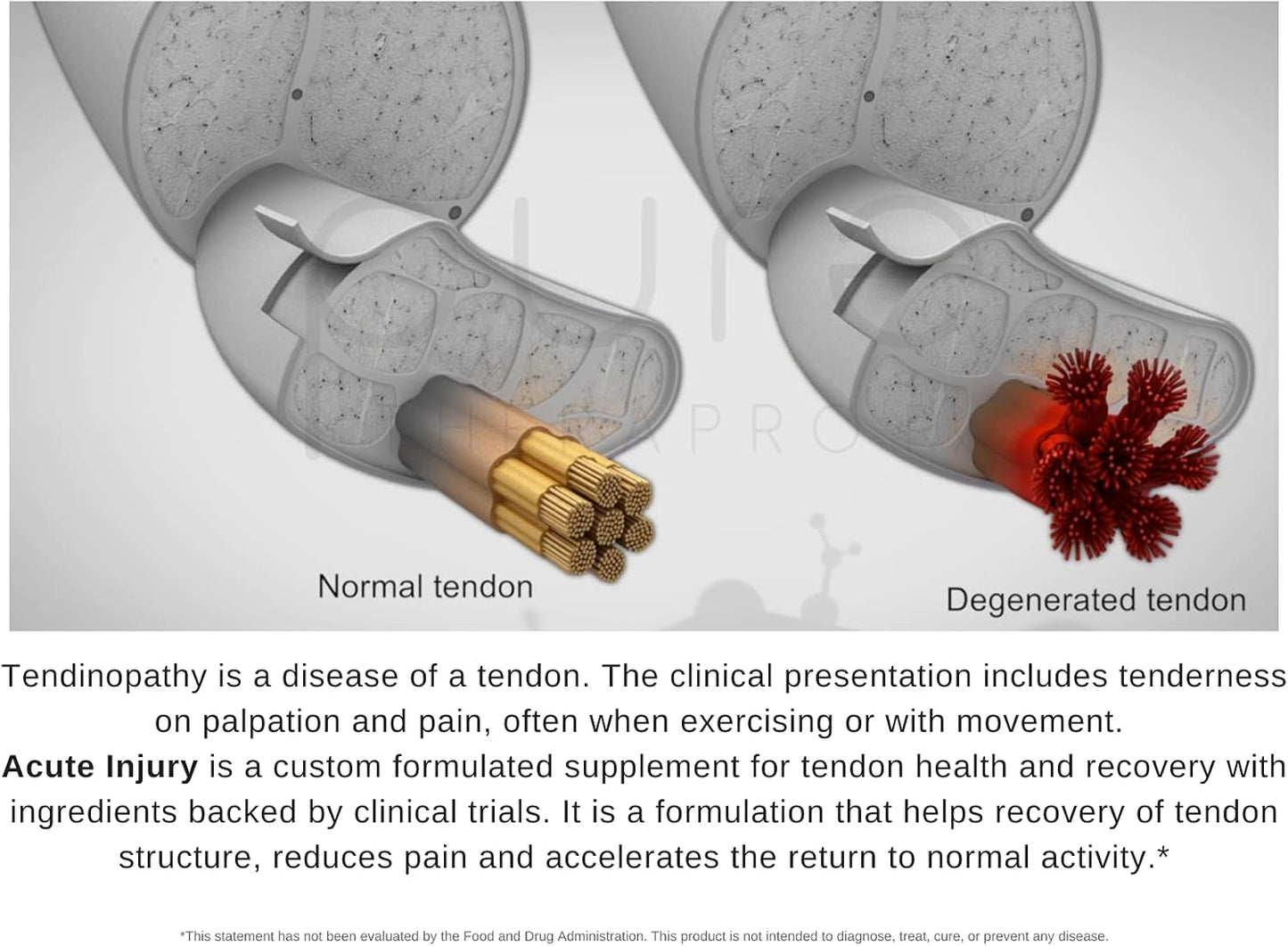 Therapro Rx Bundle for Healthy Joints and Tendons - Improve Joint Health Naturally with this Supplement Pack