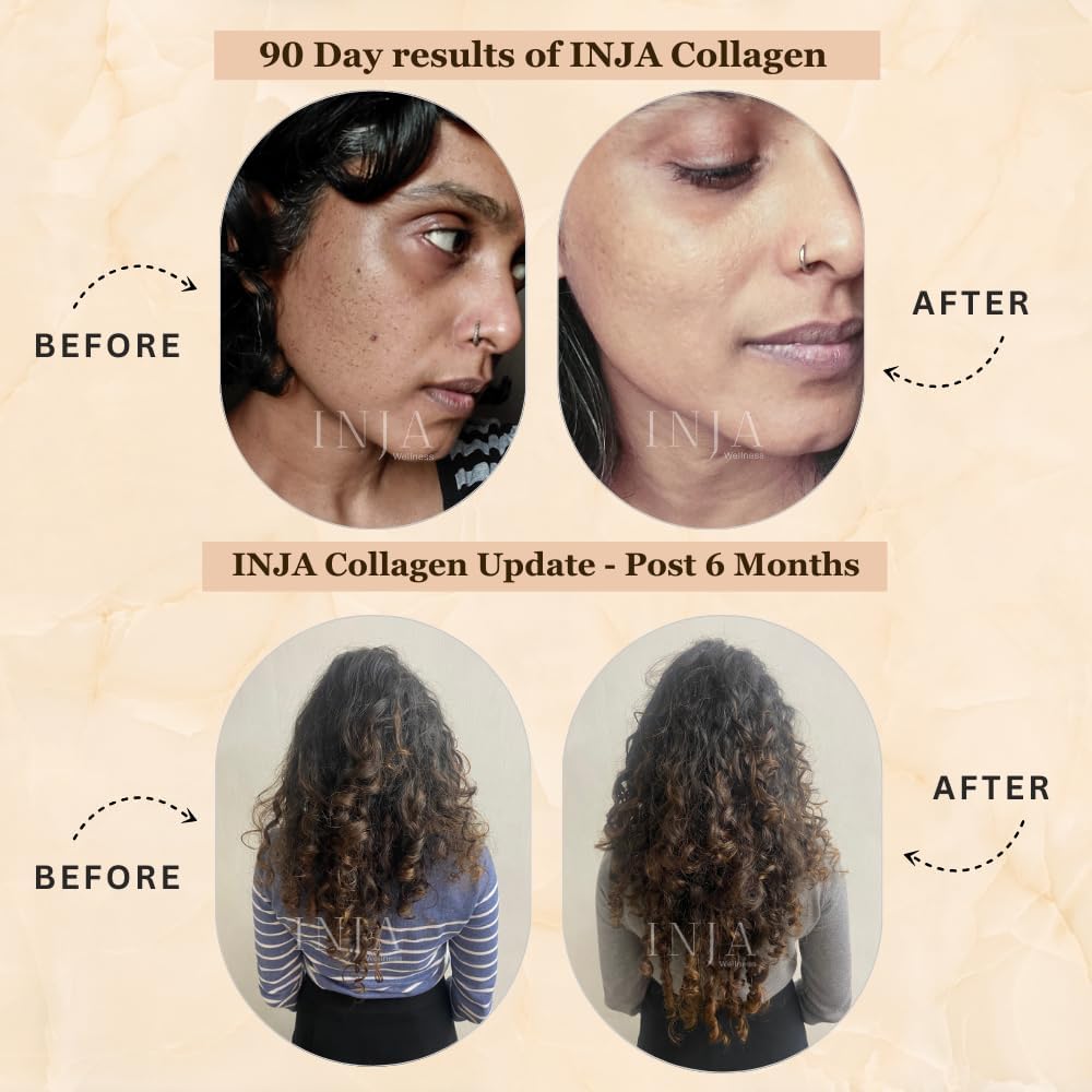 Vegan Collagen Powder Supplement for Skin and Hair Health, No Added Sugar, Anti-Aging Formula for Men and Women